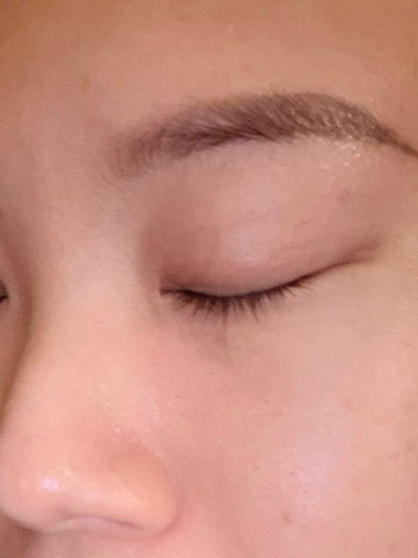 AHC 醫美科研水光導入玻尿酸全臉眼霜 真實評價/用後感 bysiu***************.hk 1 AHC 醫美科研水光導入玻尿酸全臉眼霜 真實評價/實測照片 bysiu***************.hk 1