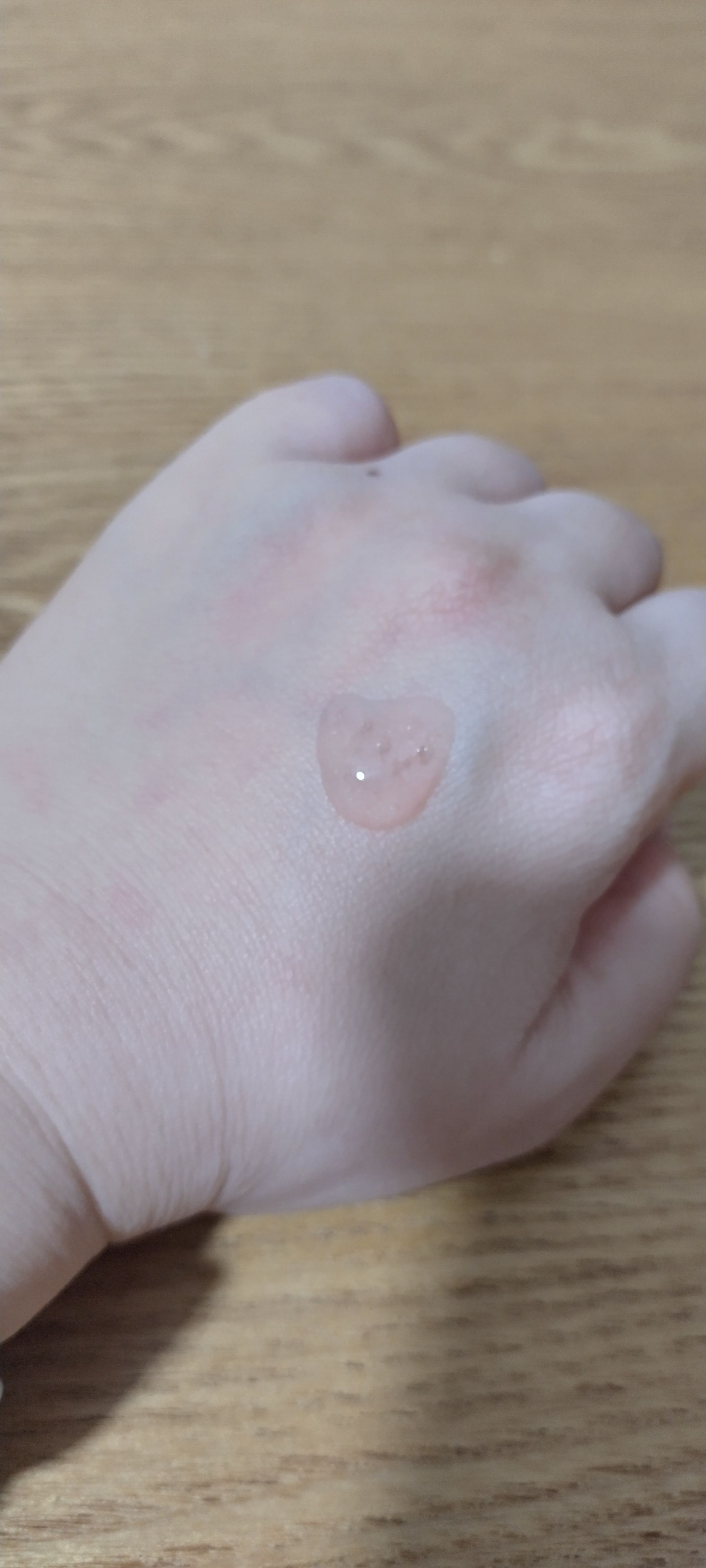 Laneige 膠原彈滑嫩肌精華 真實評價/用後感 byCha***********ona 1 Laneige 膠原彈滑嫩肌精華 真實評價/實測照片 byCha***********ona 1