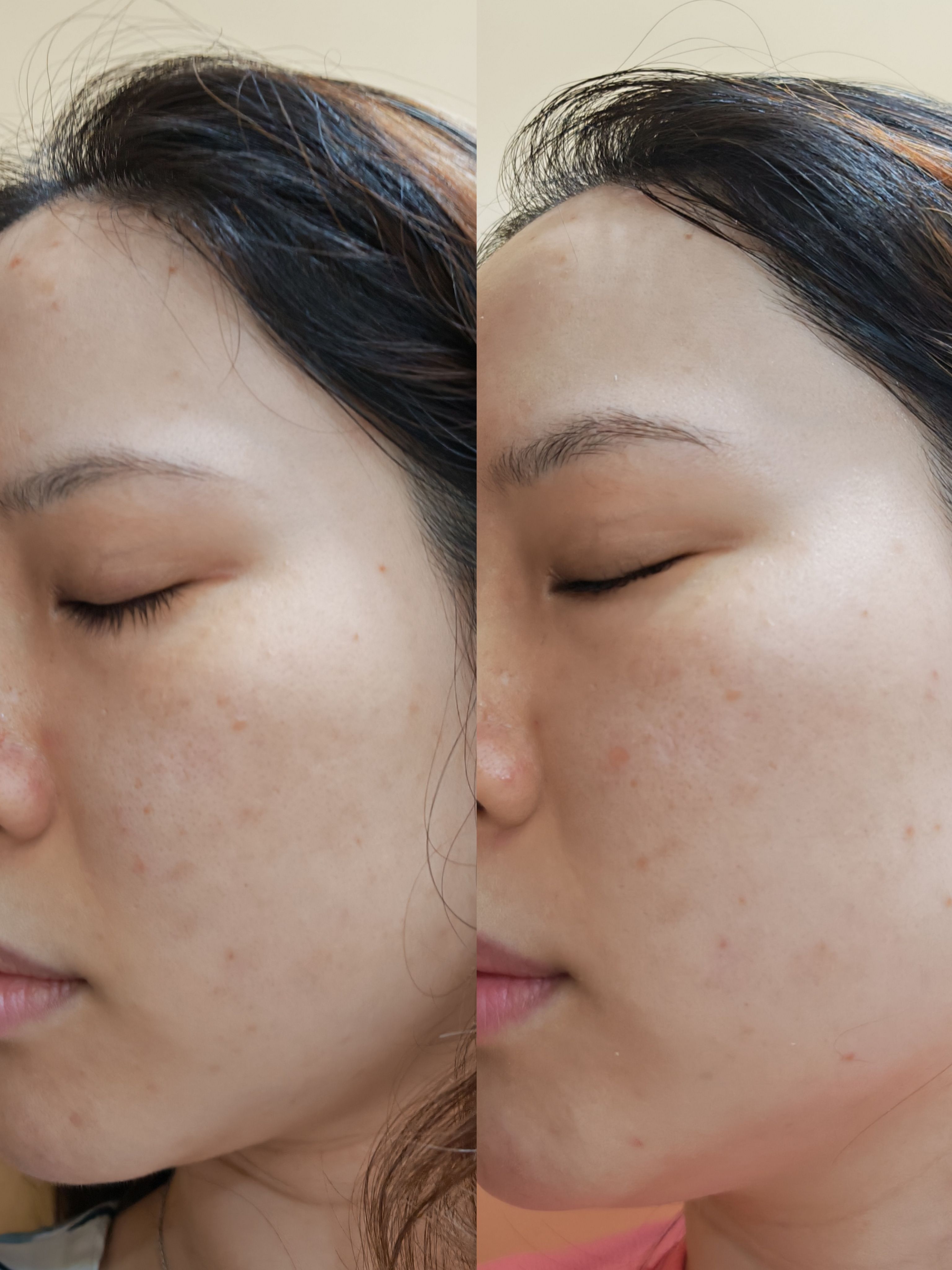 Nivea LUMINOUS630 專研多重淡斑透白精華 真實評價/用後感 byKAR***YIM 2 Nivea LUMINOUS630 專研多重淡斑透白精華 真實評價/實測照片 byKAR***YIM 2