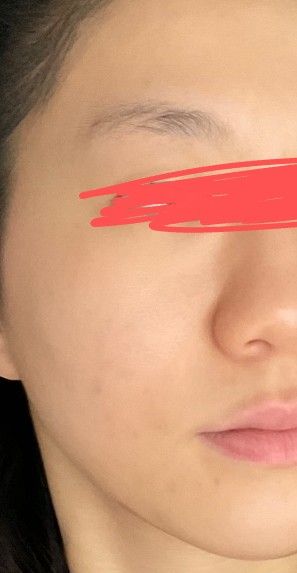 Sasatinnie 第三代升級版全效水潤透光面膜 真實評價/實測照片 bymei********************.hk 2
