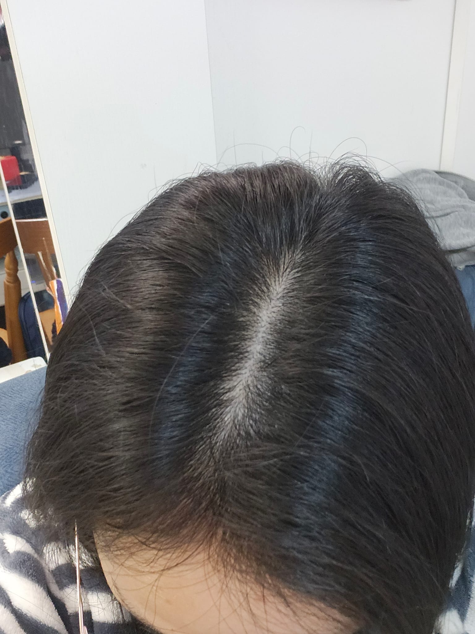 YUTAKANA豐盛生活 煥髮奇蹟生髮潤黑激活精華噴霧 真實評價/實測照片 byHua*****ndy 3