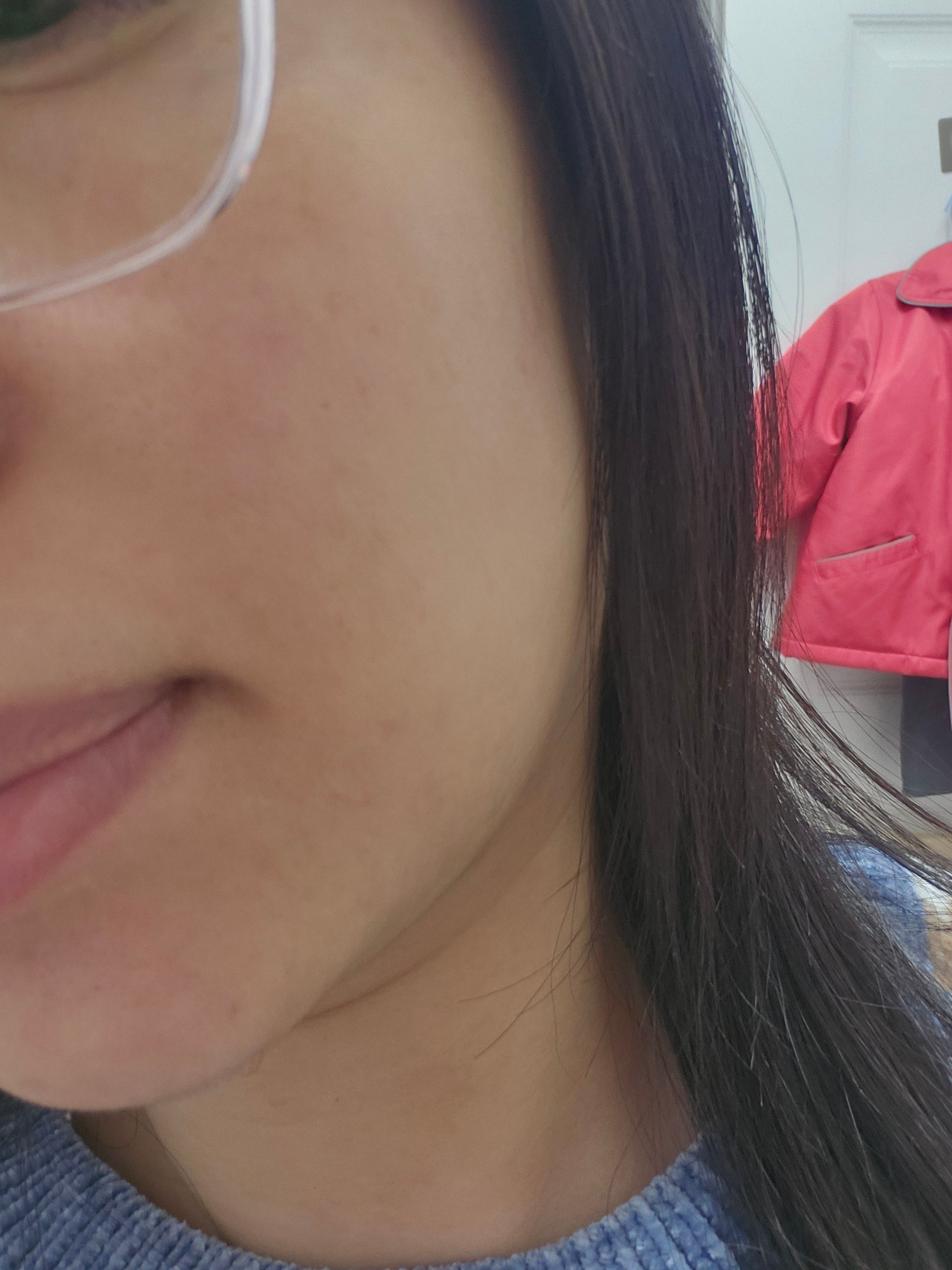 曼秀雷敦 Mentholatum 雪蓮花亮白淨化酵素面膜 真實評價/用後感 byHua*****ndy 2 曼秀雷敦 Mentholatum 雪蓮花亮白淨化酵素面膜 真實評價/實測照片 byHua*****ndy 2