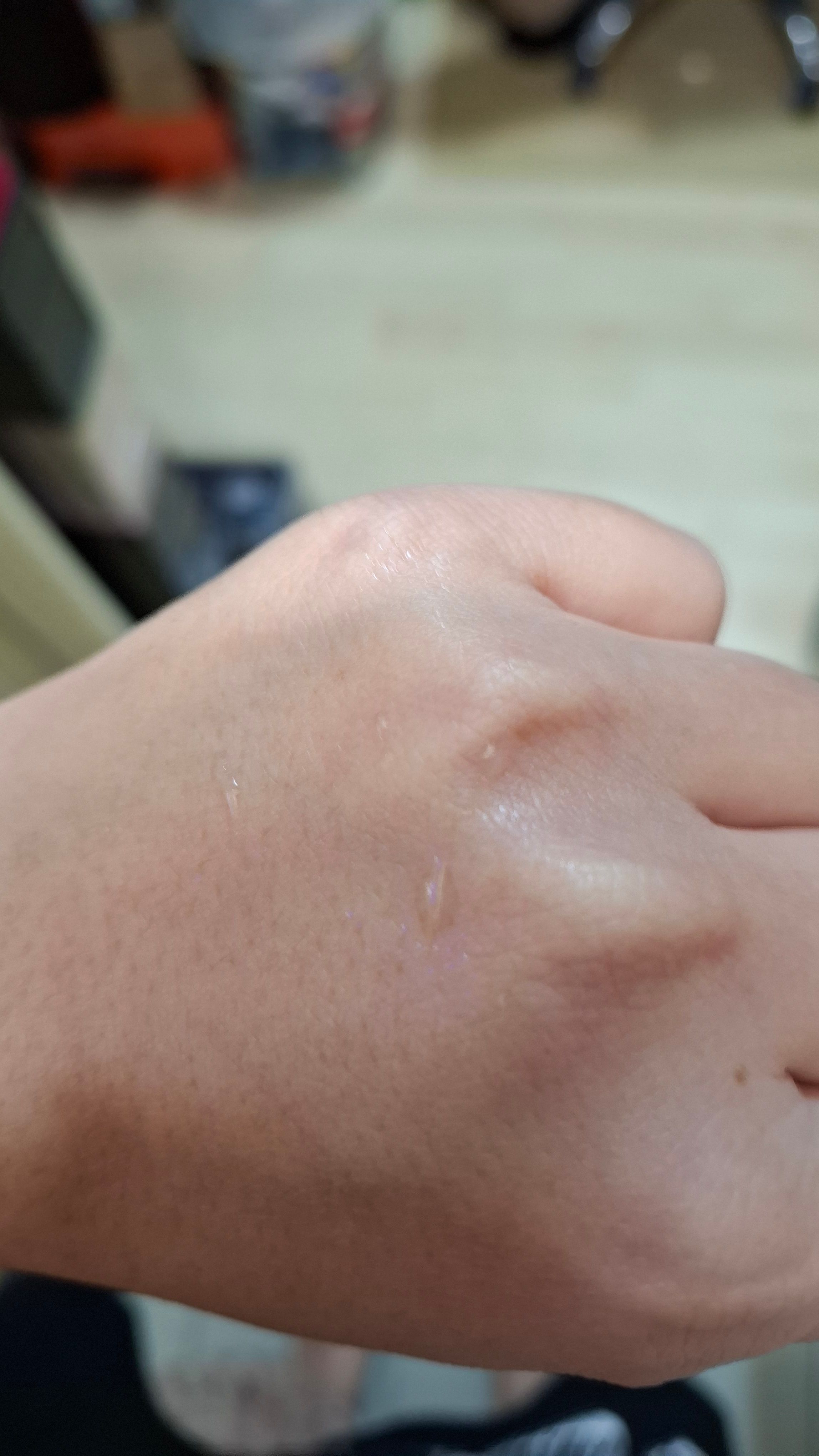 WELLAGE 唯拉珠 積雪草舒緩安瓶精華 真實評價/實測照片 by 1