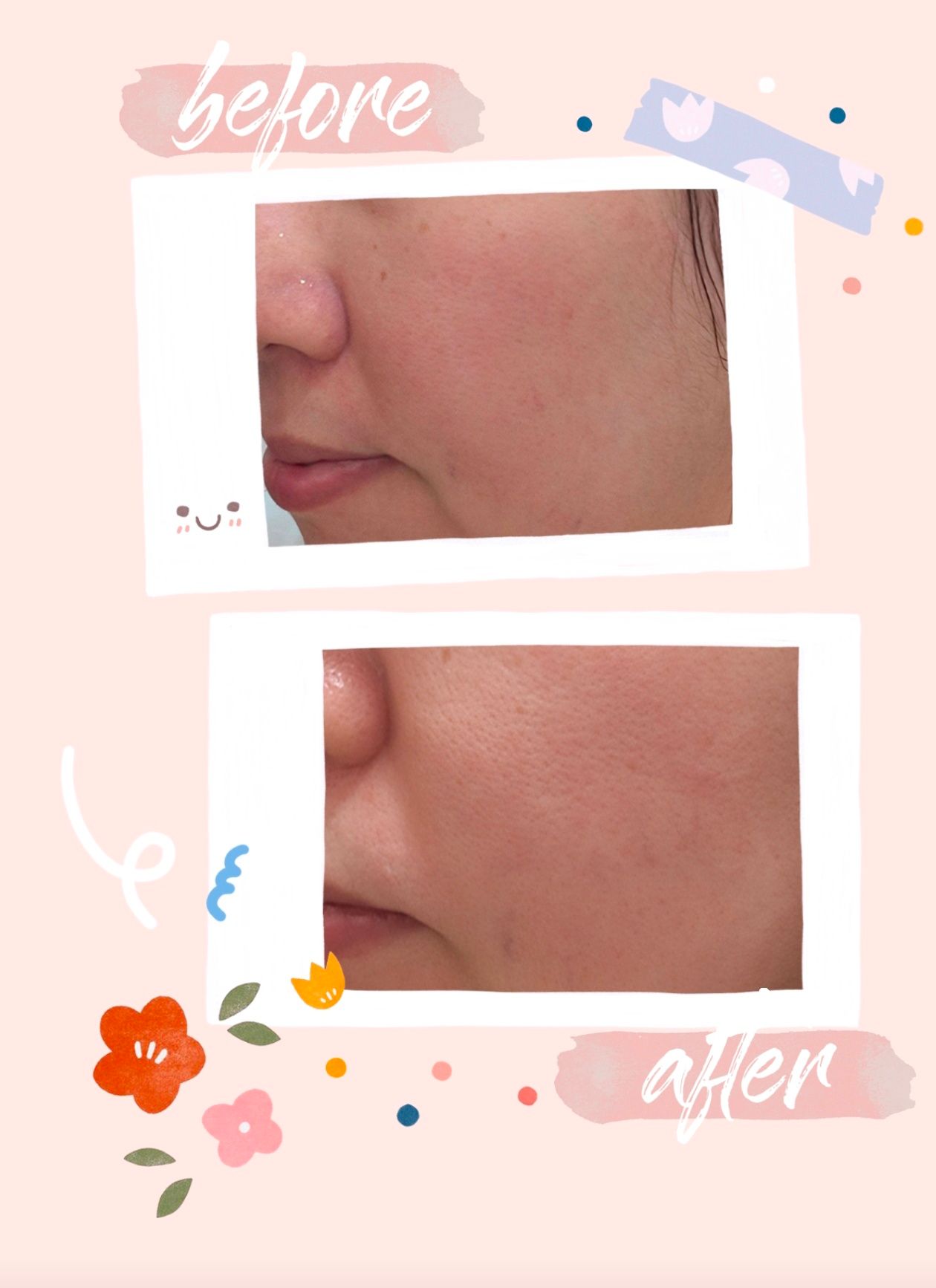 Sasatinnie 第三代升級版全效水潤透光面膜 真實評價/實測照片 bySta*****tar 1