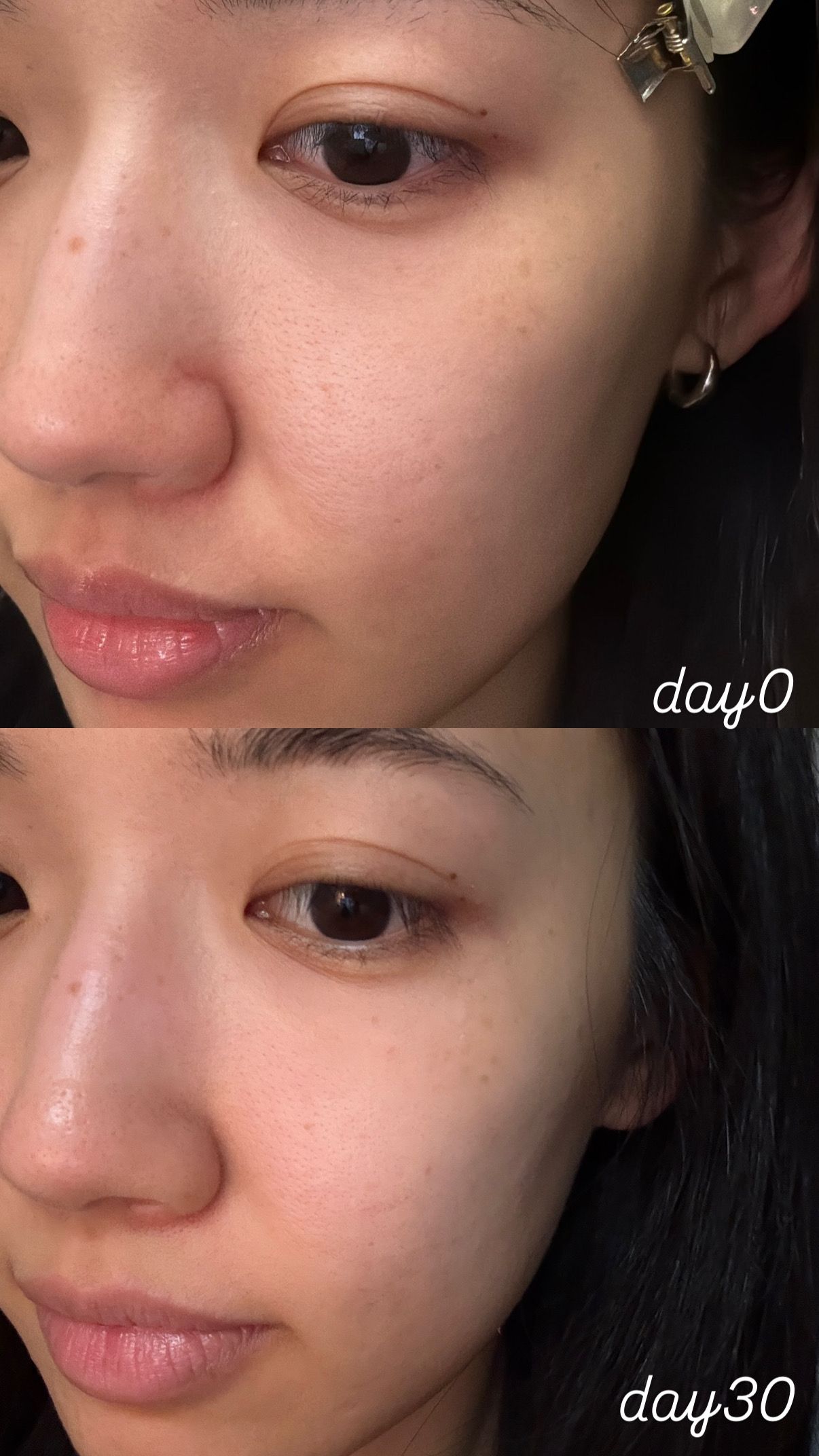 Skin Need 04G 抗醣抗氧阿魏酸BCE精華 真實評價/用後感 bybe****be 1 Skin Need 04G 抗醣抗氧阿魏酸BCE精華 真實評價/實測照片 bybe****be 1