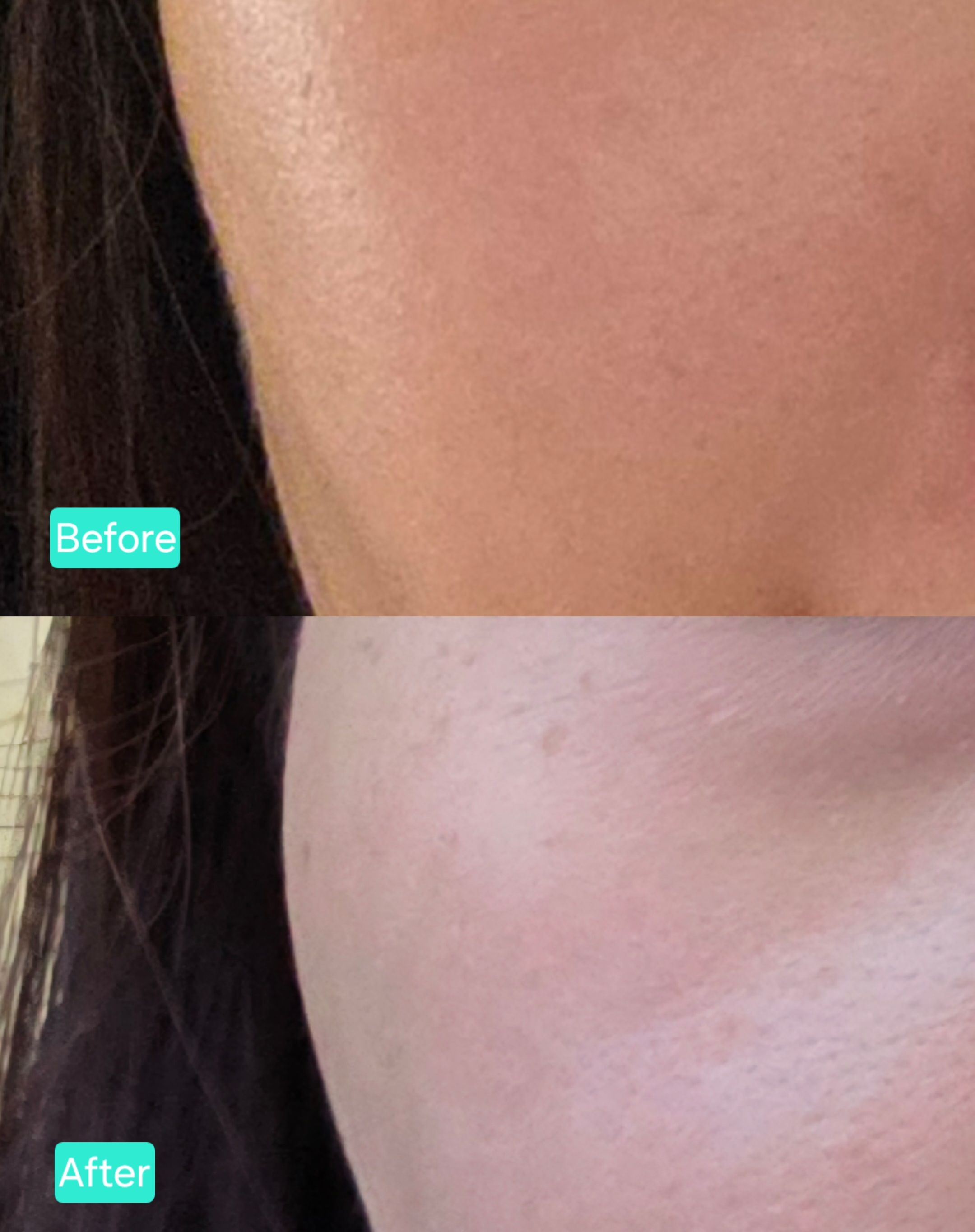 La Roche-Posay 極效修復面膜 真實評價/用後感 byJen****han 1 La Roche-Posay 極效修復面膜 真實評價/實測照片 byJen****han 1