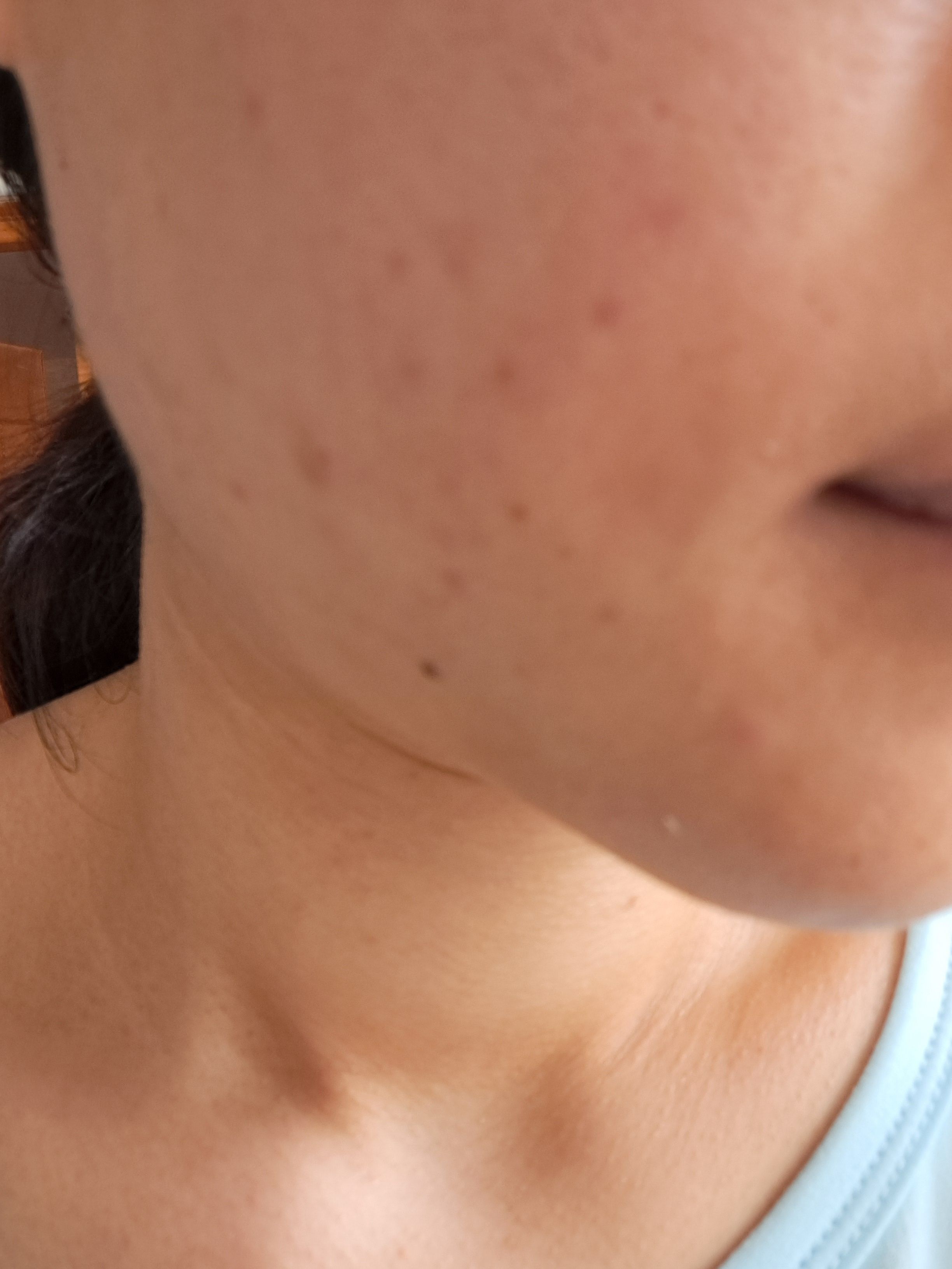 Kiehl's 醫學維C淡斑精華 真實評價/用後感 byicy*****************com 2 Kiehl's 醫學維C淡斑精華 真實評價/實測照片 byicy*****************com 2