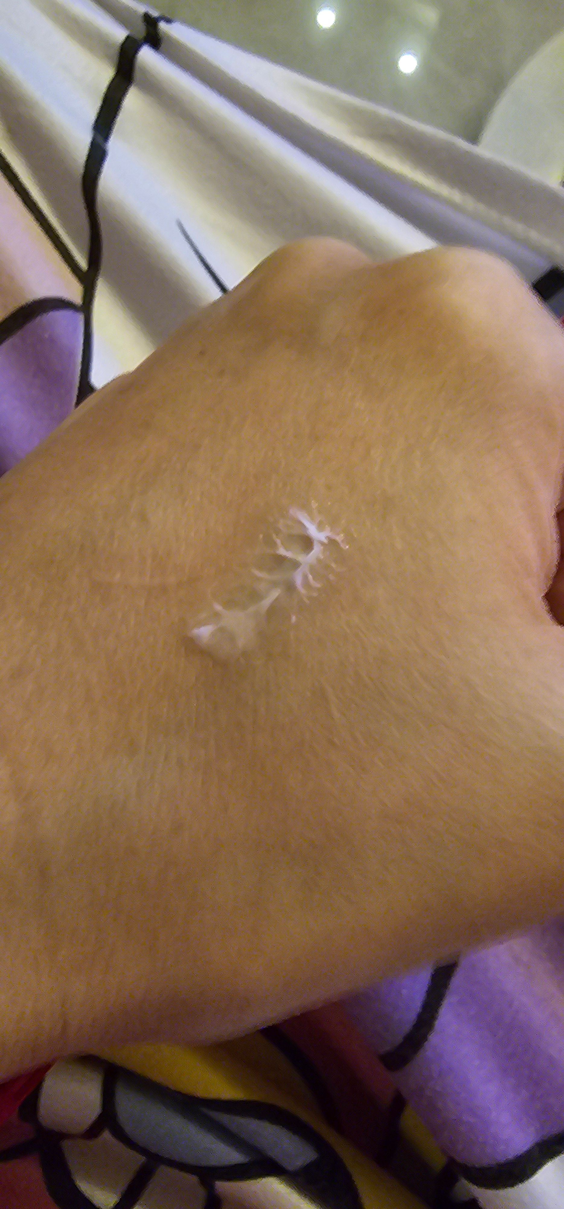 曼秀雷敦 Mentholatum Acnes藥用抗痘潔面乳 真實評價/實測照片 byCry**** Li 1