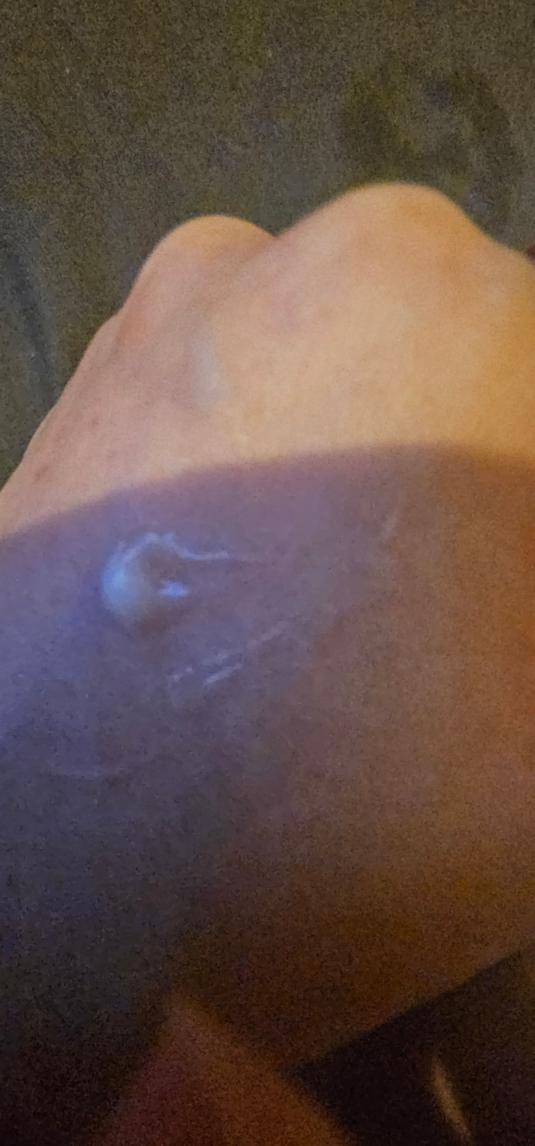 DR.G 舒潤修護保濕精華霜 R.E.D Blemish CLEAR SOOTHING CREAM 真實評價/實測照片 byCry**** Li 1