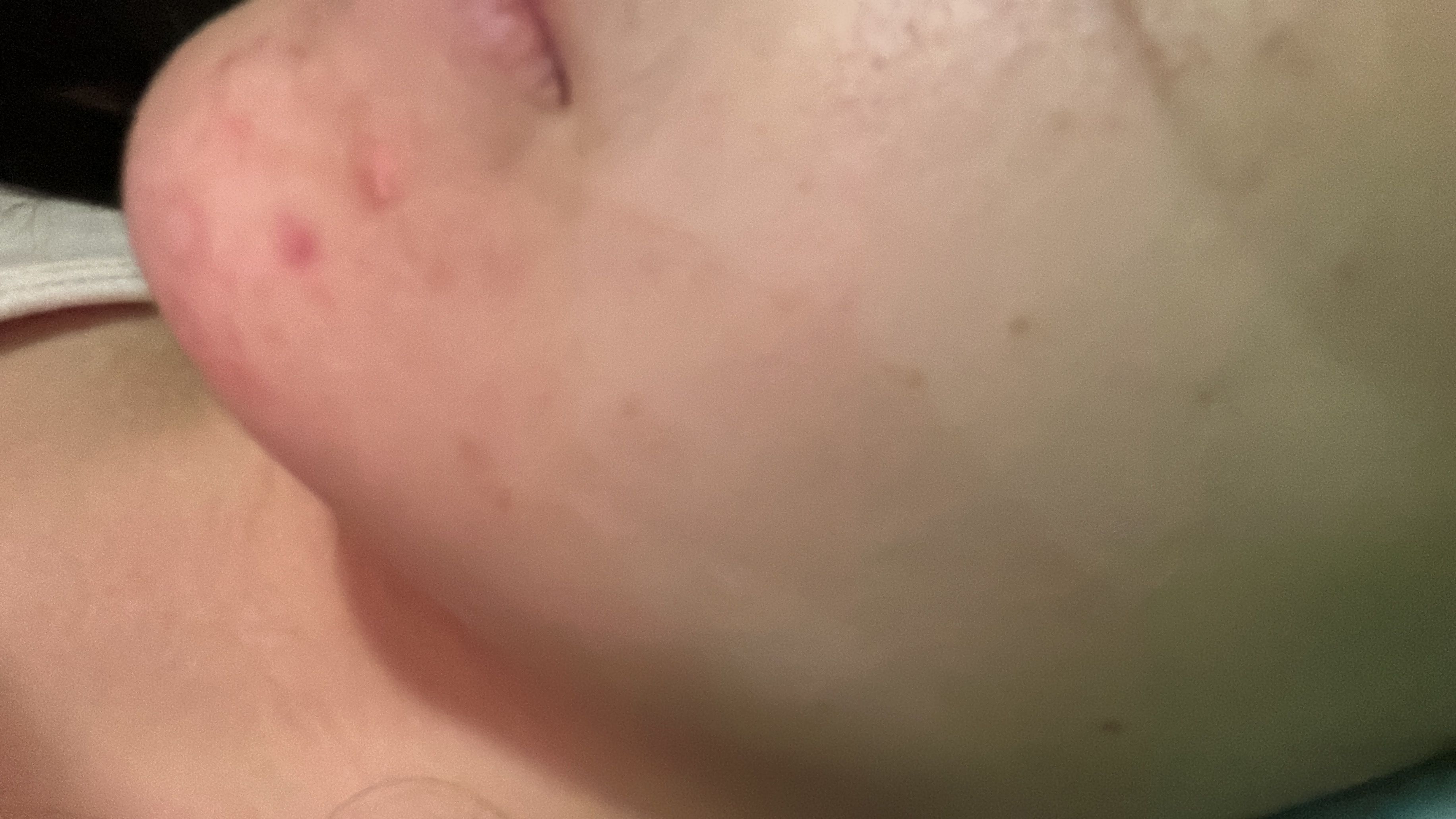 Sasatinnie 第三代升級版全效水潤透光面膜 真實評價/實測照片 byEli*****ung 1