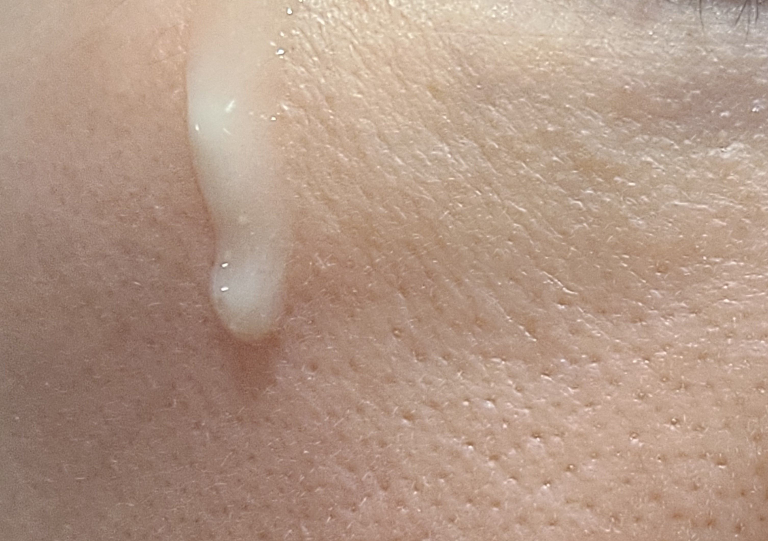 Eucerin 透明質酸緊緻充盈精華素(小銀彈) 真實評價/實測照片 byLin****ana 1
