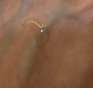 Torriden 低分子玻尿酸精華 真實評價/實測照片 by 1