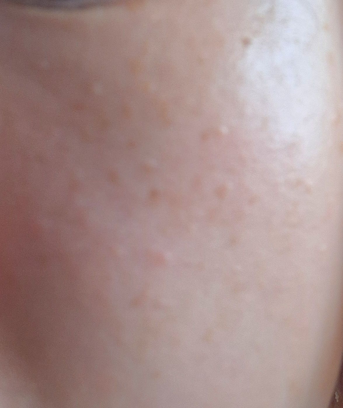 Torriden 維C美白保濕透肌面膜 真實評價/實測照片 byPa**la 1