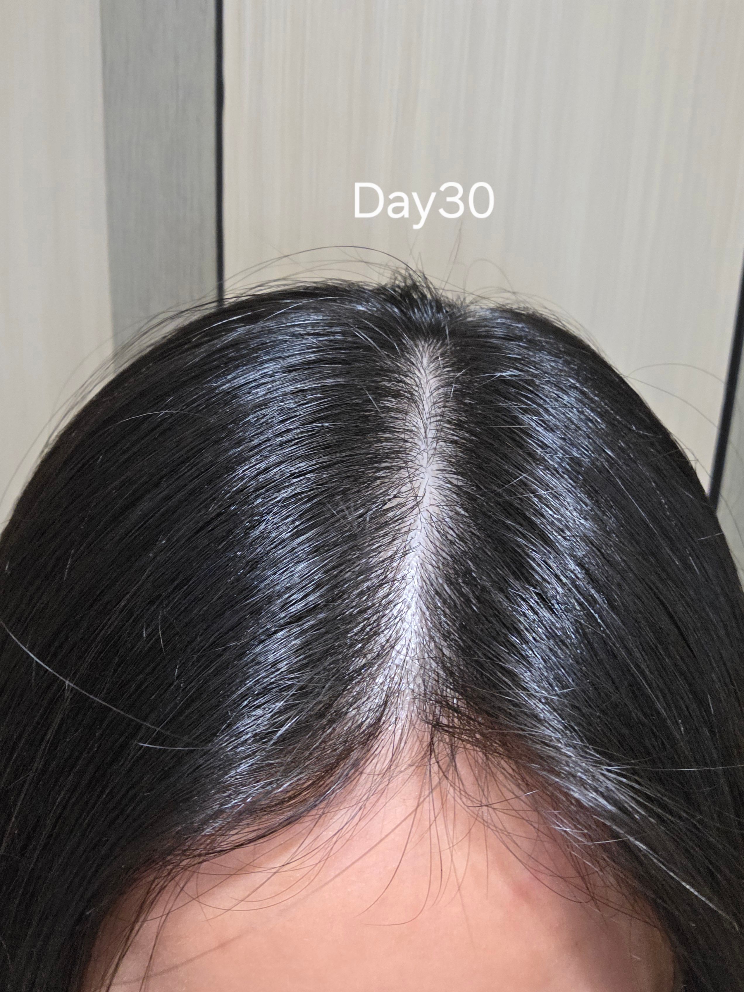 YUTAKANA豐盛生活 煥髮奇蹟生髮潤黑激活精華噴霧 真實評價/實測照片 byAnn****wok 1