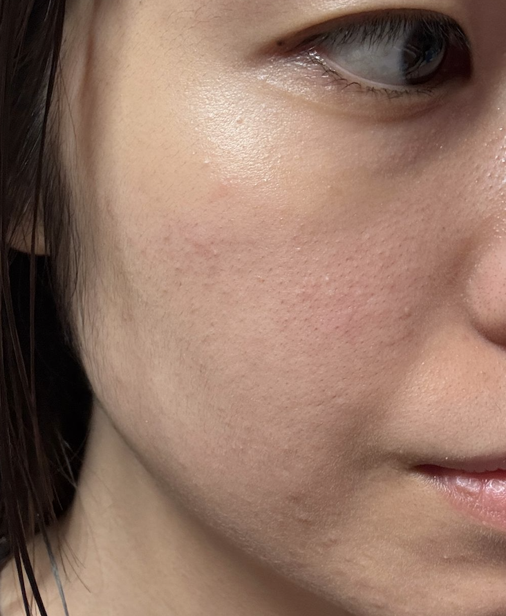 AHC 醫美科研水光導入玻尿酸全臉眼霜 真實評價/實測照片 byCai******han 2