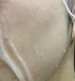 曼秀雷敦 Mentholatum 海藻糖保濕精華鮮注面膜 真實評價/用後感 byMr***se 1 曼秀雷敦 Mentholatum 海藻糖保濕精華鮮注面膜 真實評價/實測照片 byMr***se 1