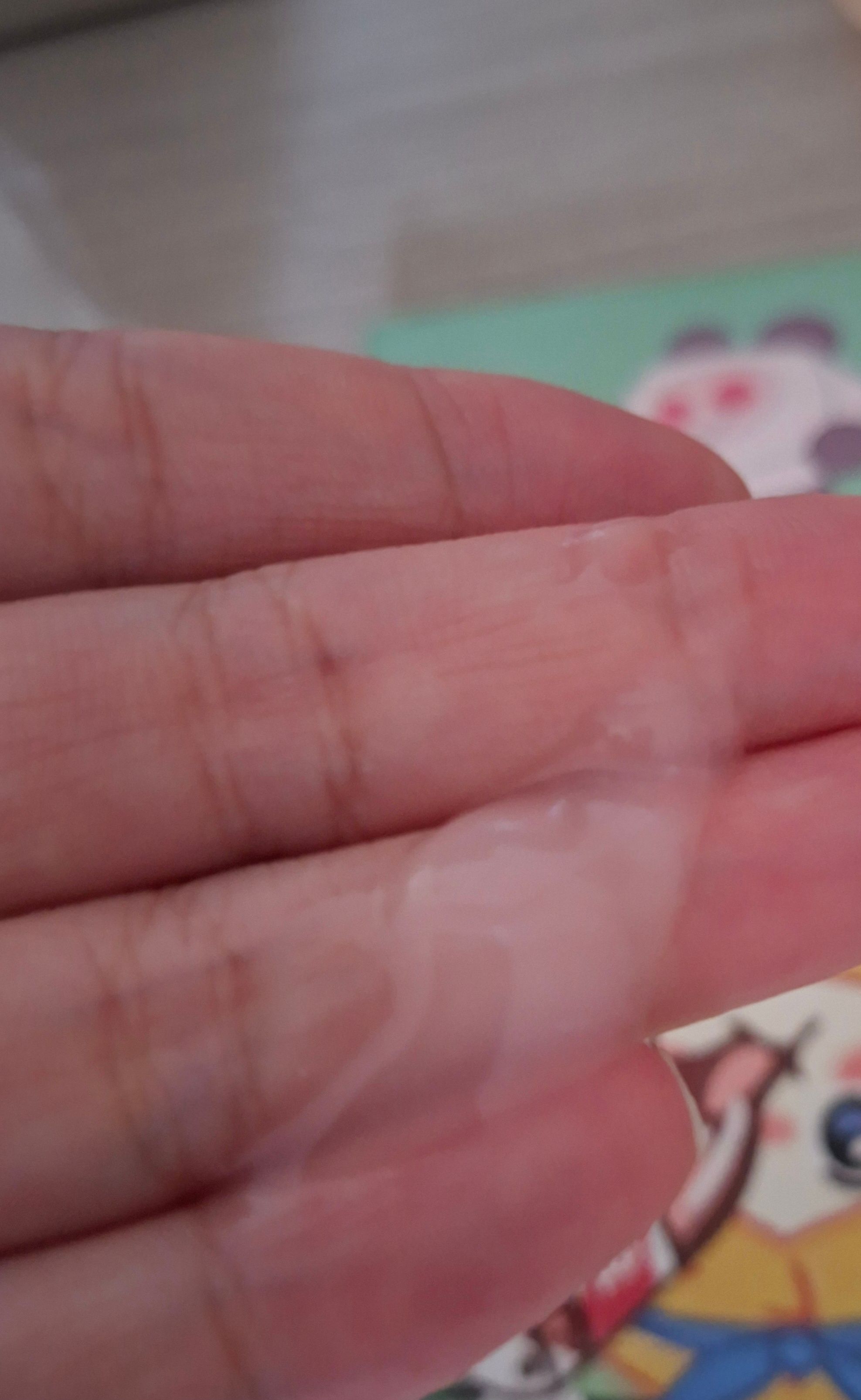 BIO HEAL BOH 益生菌膠原蛋白重塑緊緻收毛孔PDRN微針精華 真實評價/實測照片 byC*n 1