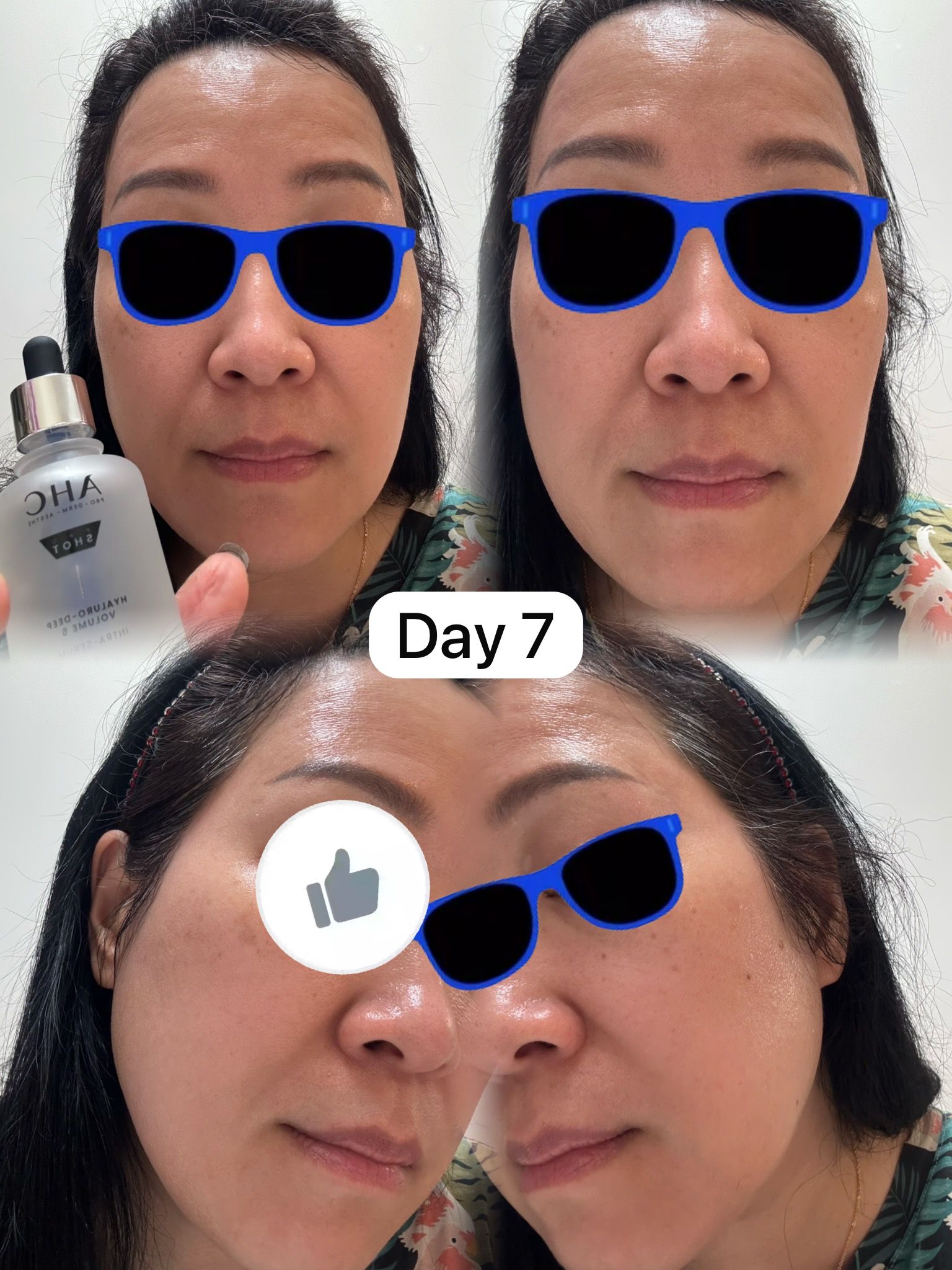 AHC 醫美科妍水光導入玻尿酸精華 真實評價/實測照片 bykla************com 2