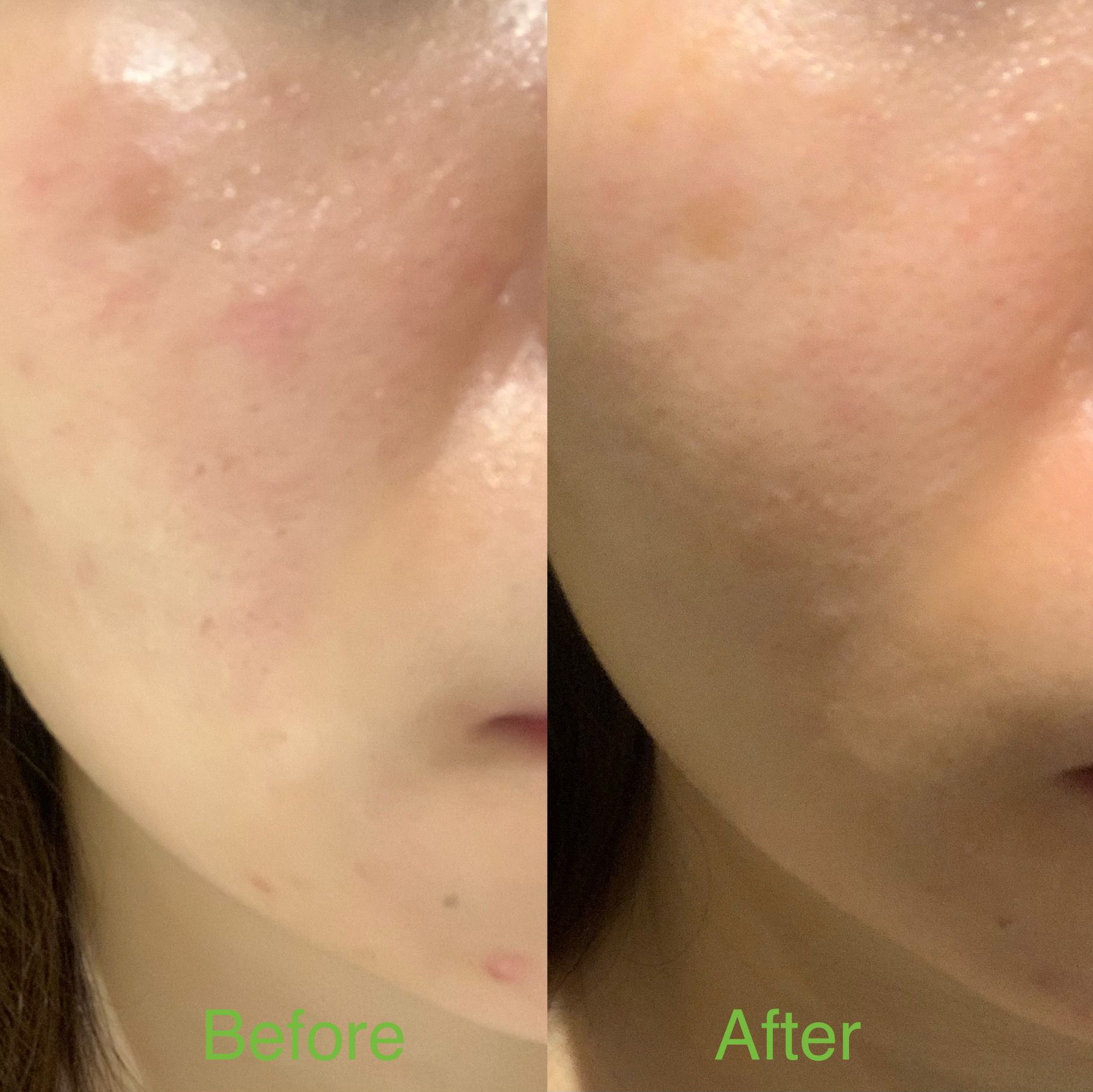 御容鑑 皇御秘方活養精華 真實評價/實測照片 byA* 1