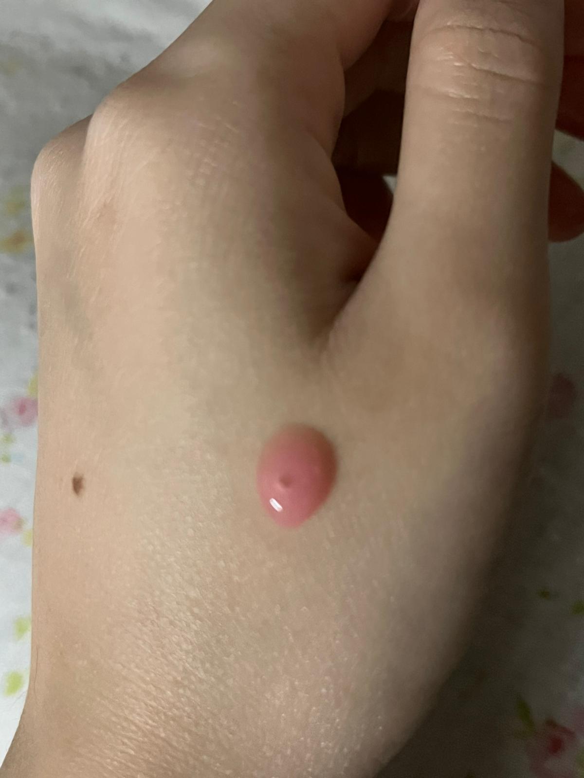 Medicube PDRN 粉紅胜肽膠原蛋白安瓶 真實評價/實測照片 byCry******ang 1