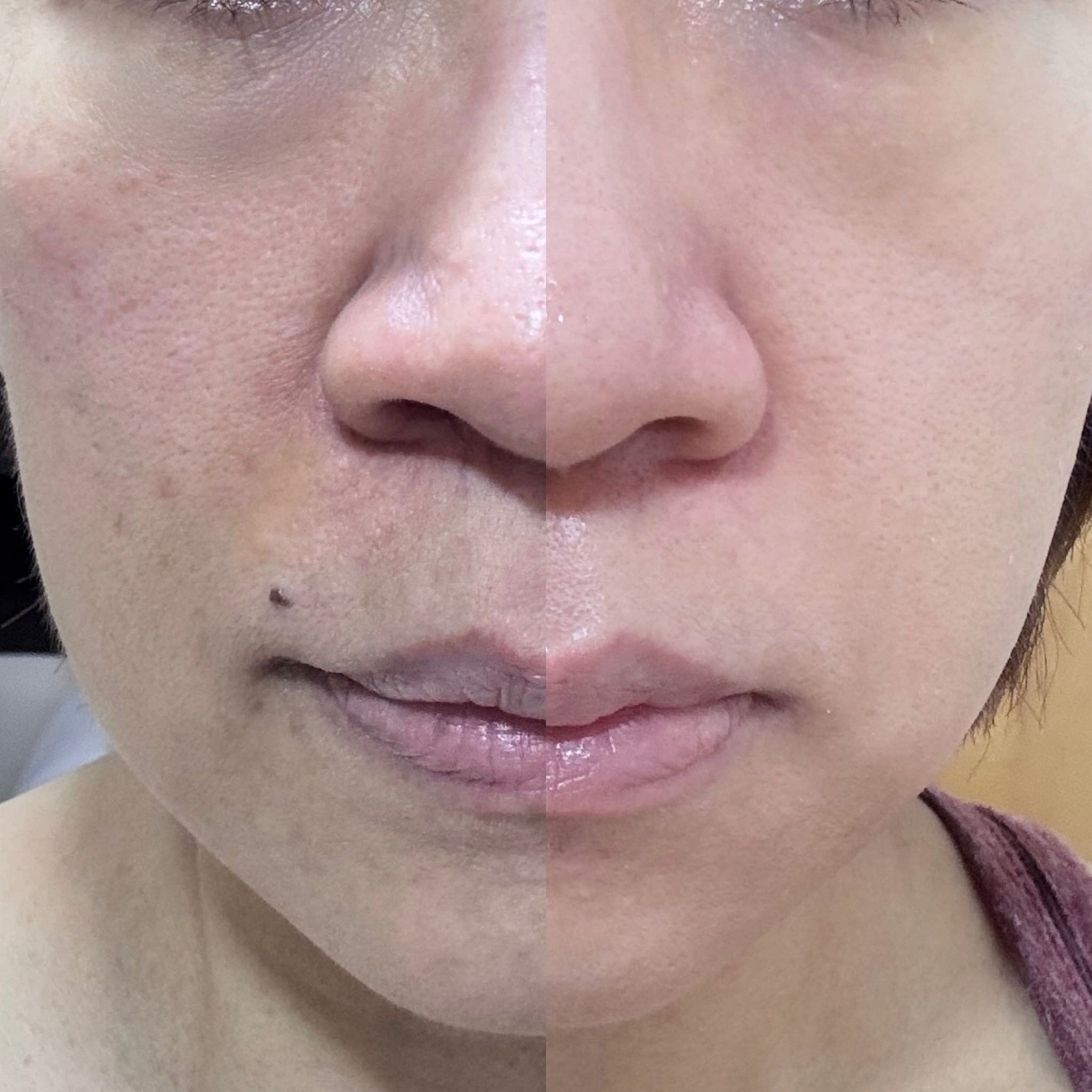 Olay 水感透白光曜精華 (水光小白瓶) 真實評價/實測照片 byLi****ng 1