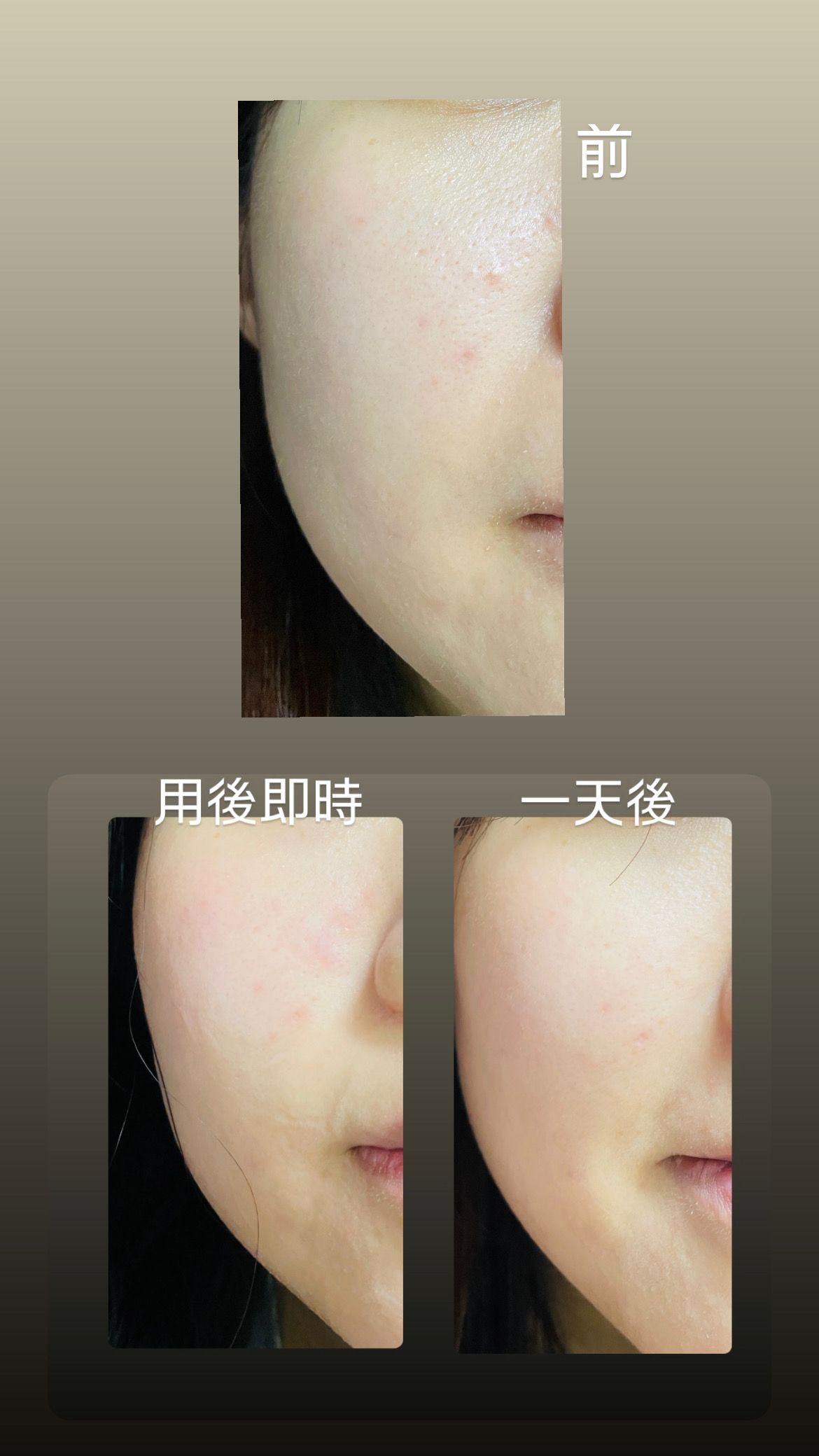 Typer PMS Care Mask 真實評價/實測照片 byThe*******zon 1