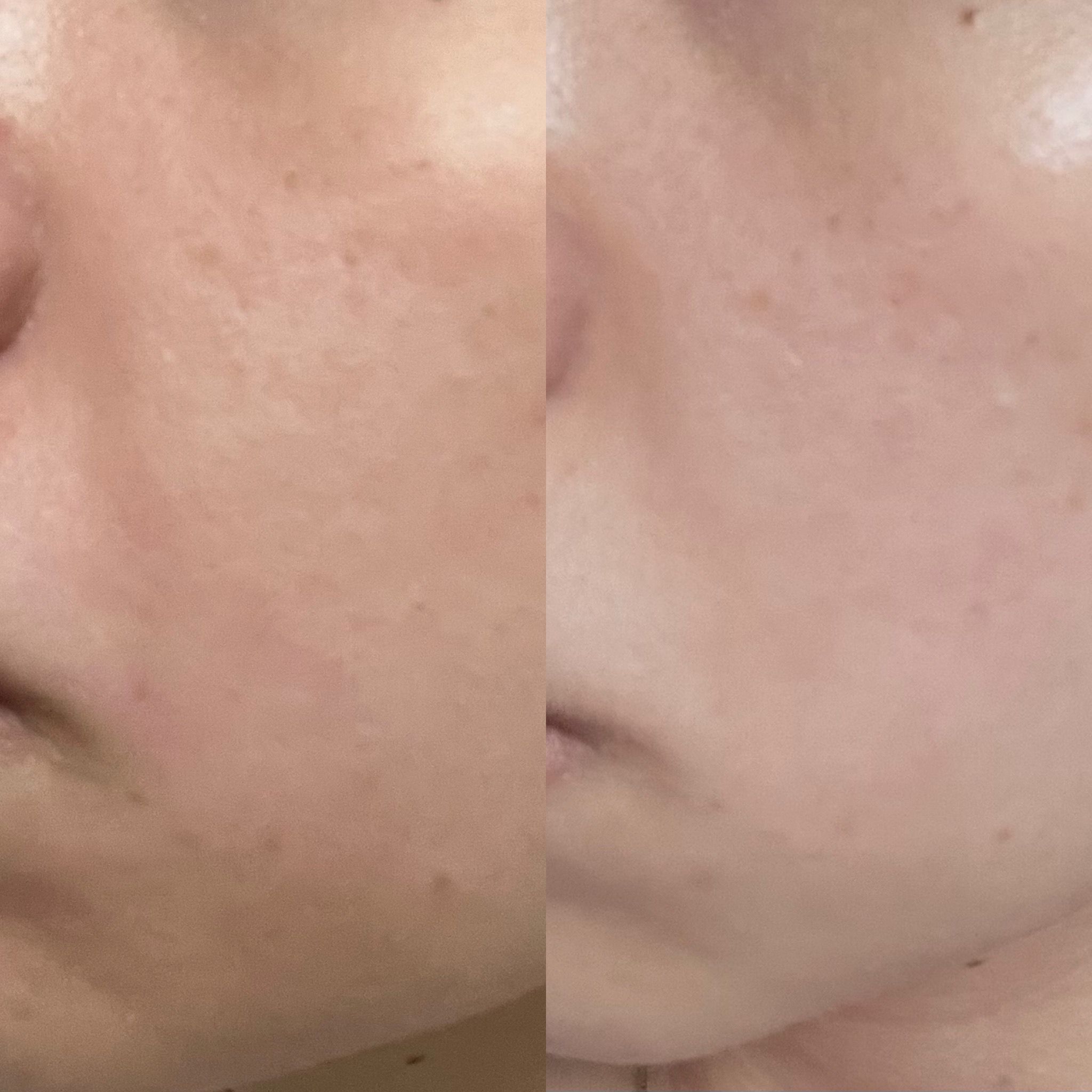 Olay 胜肽專研緊緻輕潤乳霜 (紅金面霜) 真實評價/實測照片 bylo**oo 2