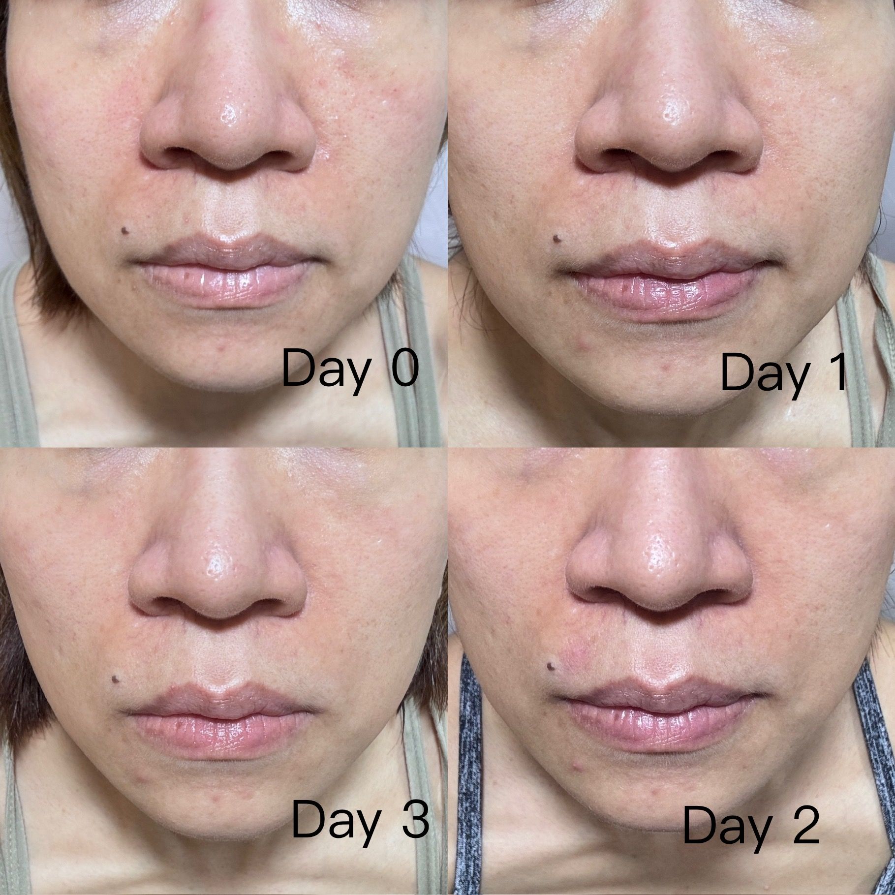 Sasatinnie 第三代升級版全效水潤透光面膜 真實評價/實測照片 byLi****ng 2