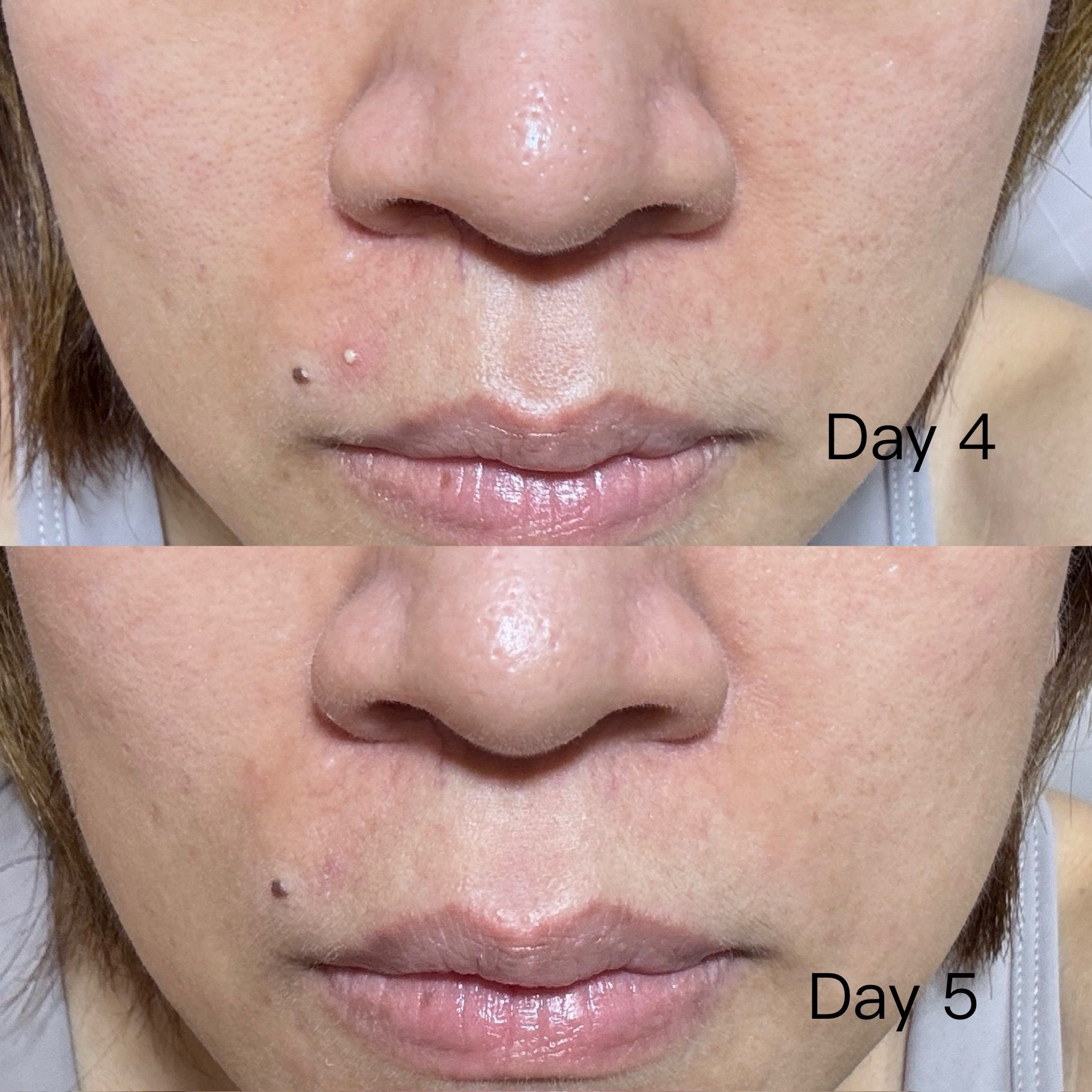 Sasatinnie 第三代升級版全效水潤透光面膜 真實評價/實測照片 byLi****ng 1