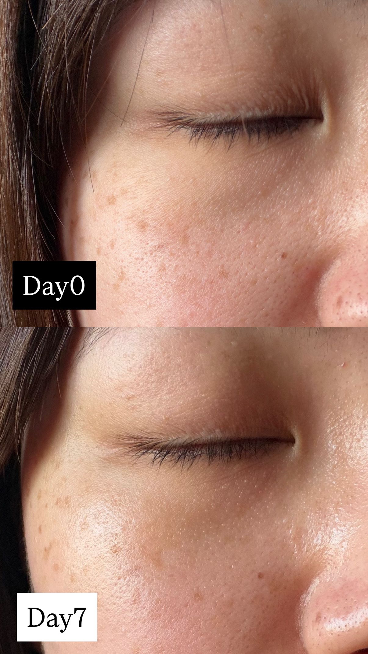 AHC 醫美科研水光導入玻尿酸全臉眼霜 真實評價/用後感 bybel****************com 1 AHC 醫美科研水光導入玻尿酸全臉眼霜 真實評價/實測照片 bybel****************com 1