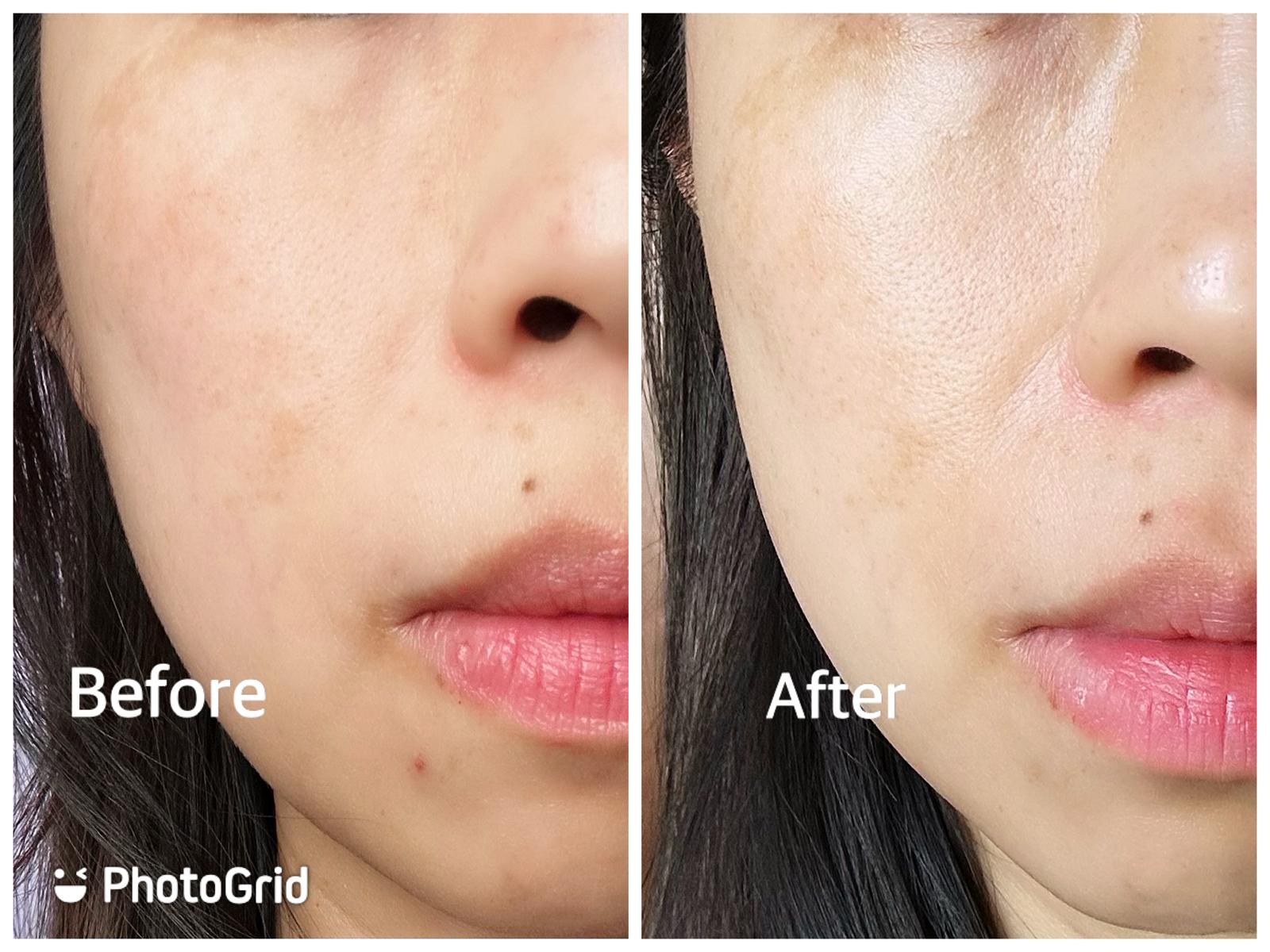 Skin Need 04F 4重維他命C精華 真實評價/用後感 byAsh*****ong 2 Skin Need 04F 4重維他命C精華 真實評價/實測照片 byAsh*****ong 2
