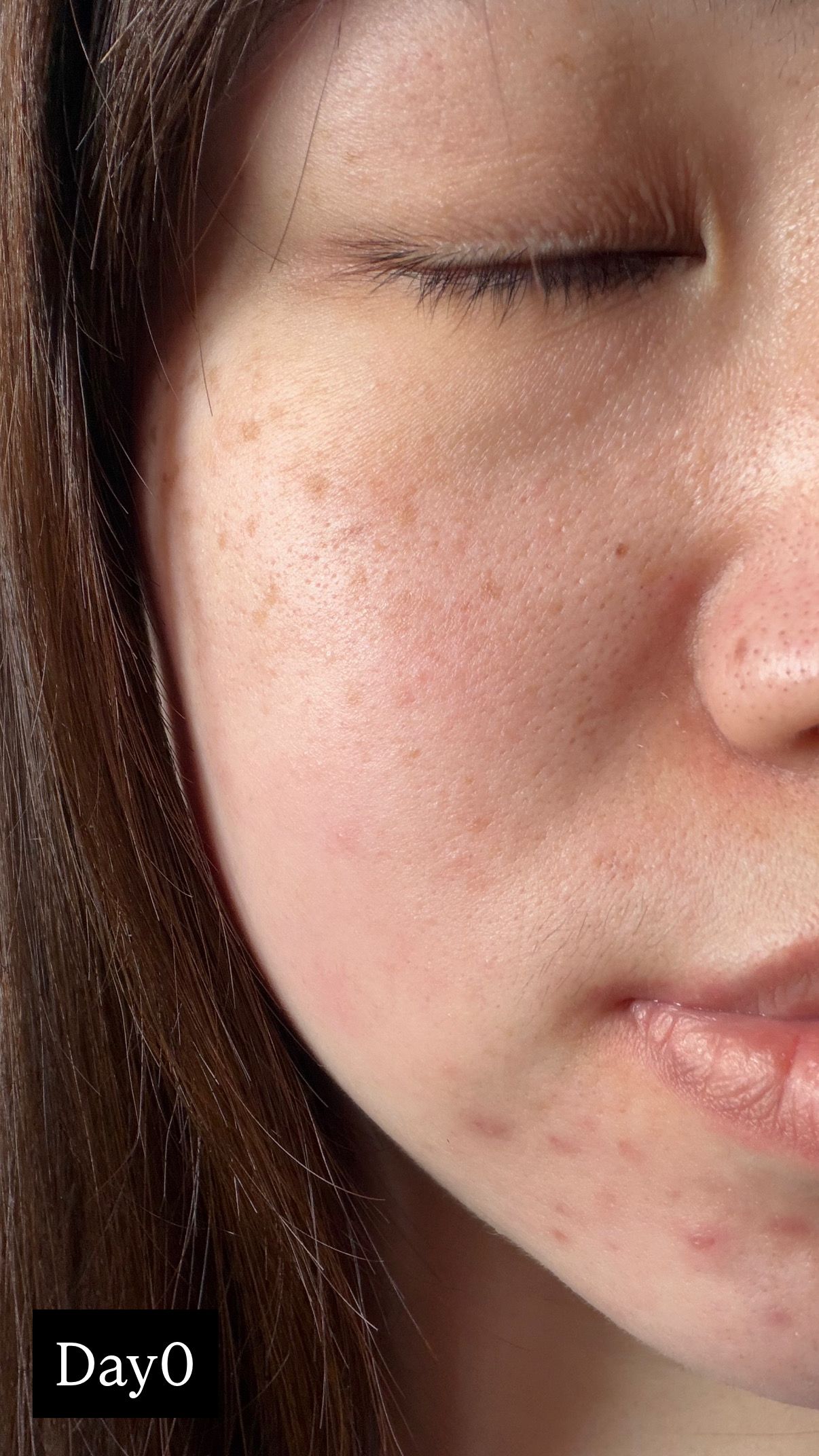 AHC 醫美科妍水光導入玻尿酸精華 真實評價/實測照片 bybel****************com 1