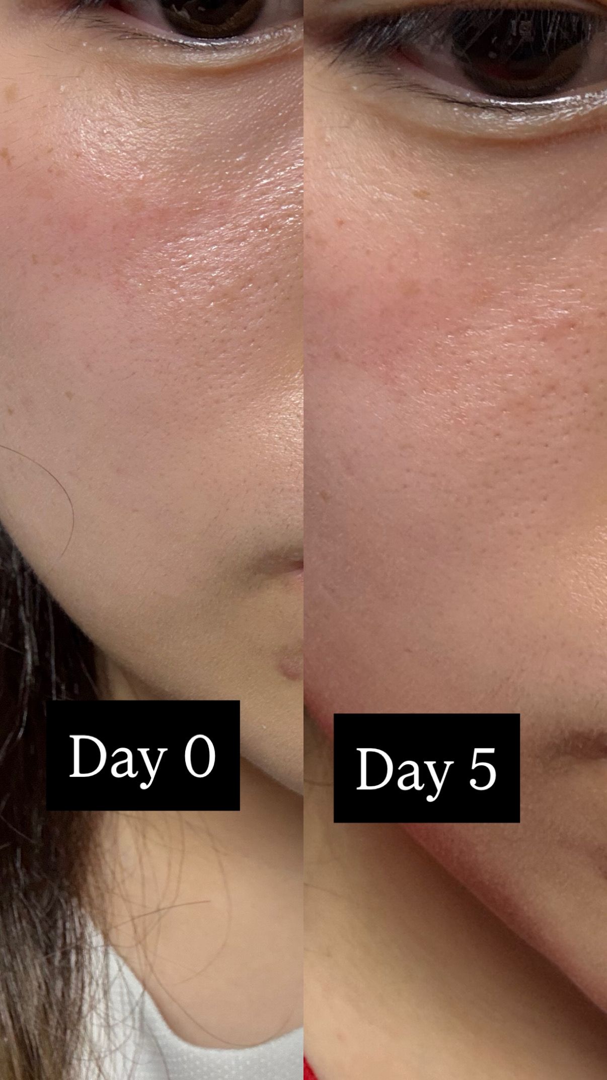 Sasatinnie 第三代升級版全效水潤透光面膜 真實評價/實測照片 bywin*************com 1