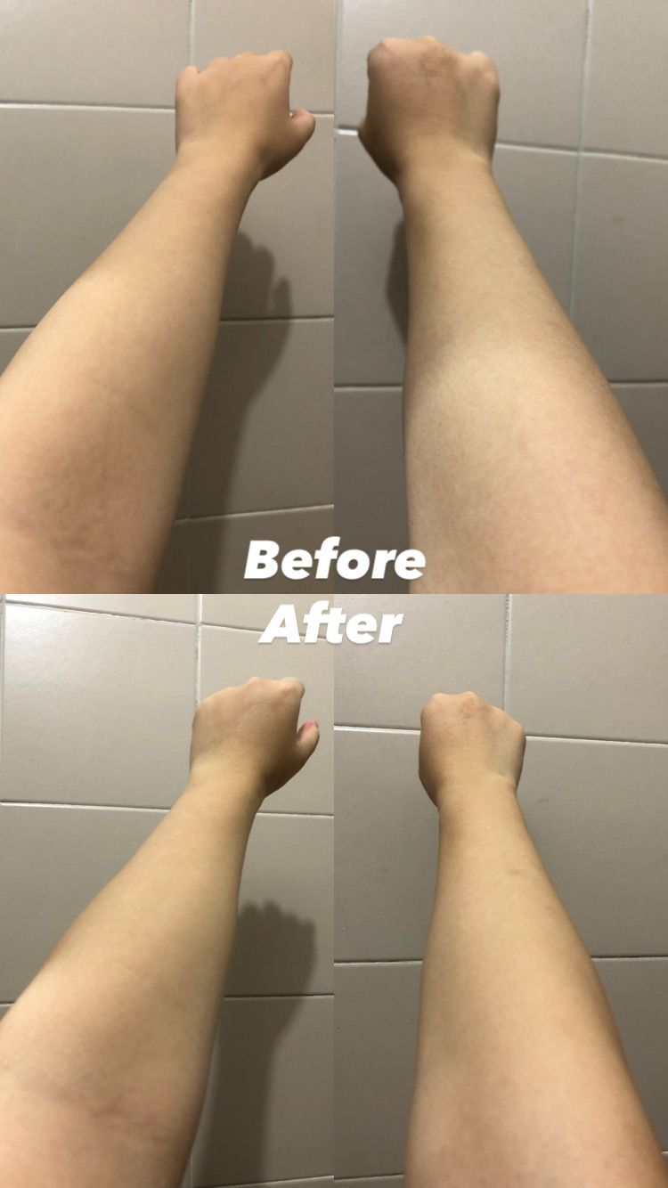 Dettol 滴露 ProSkin深層滋潤親膚沐浴乳霜 真實評價/用後感 by448**********com 1 Dettol 滴露 ProSkin深層滋潤親膚沐浴乳霜 真實評價/實測照片 by448**********com 1