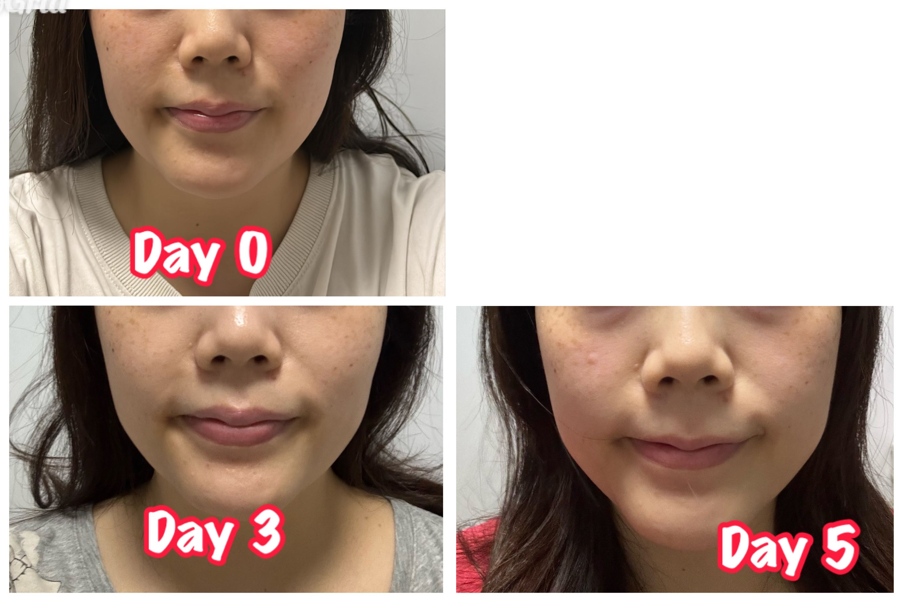 Sasatinnie 第三代升級版全效水潤透光面膜 真實評價/實測照片 byfee*************com 1