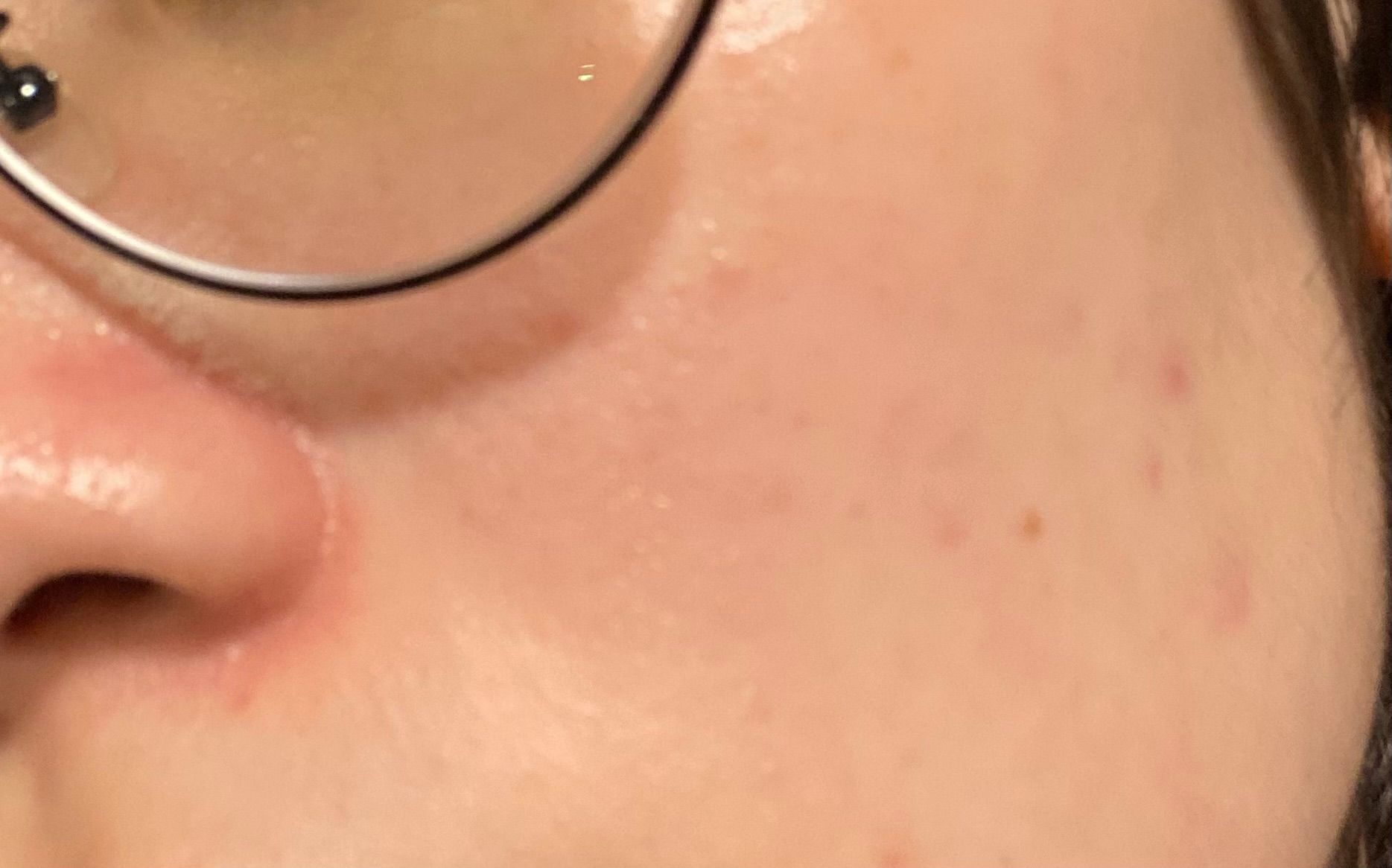 QV Face 保濕 + 再生精華 真實評價/實測照片 byW**h 2