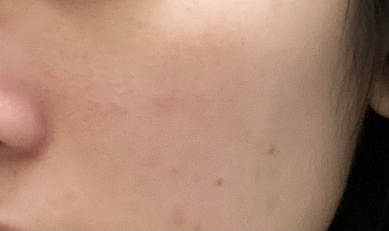 QV Face 保濕 + 再生精華 真實評價/實測照片 byW**h 1