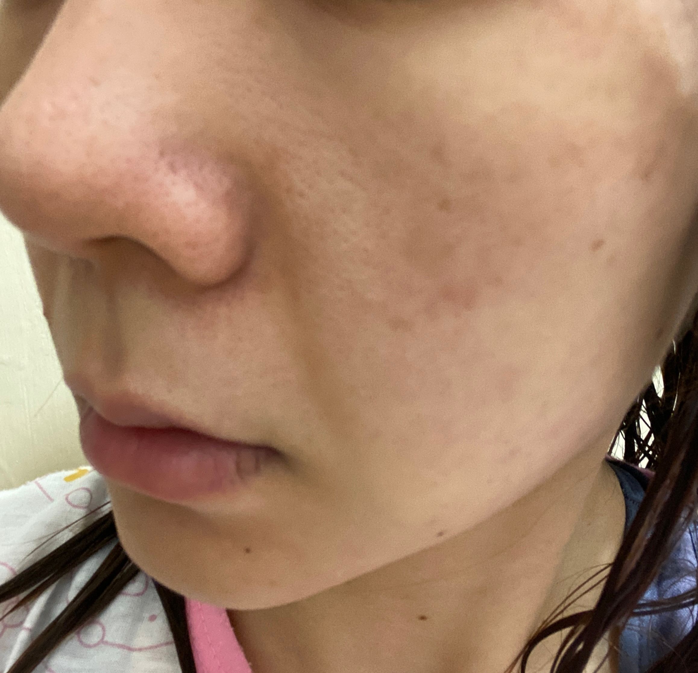 Sasatinnie 第三代升級版全效水潤透光面膜 真實評價/實測照片 bysiu************com 2