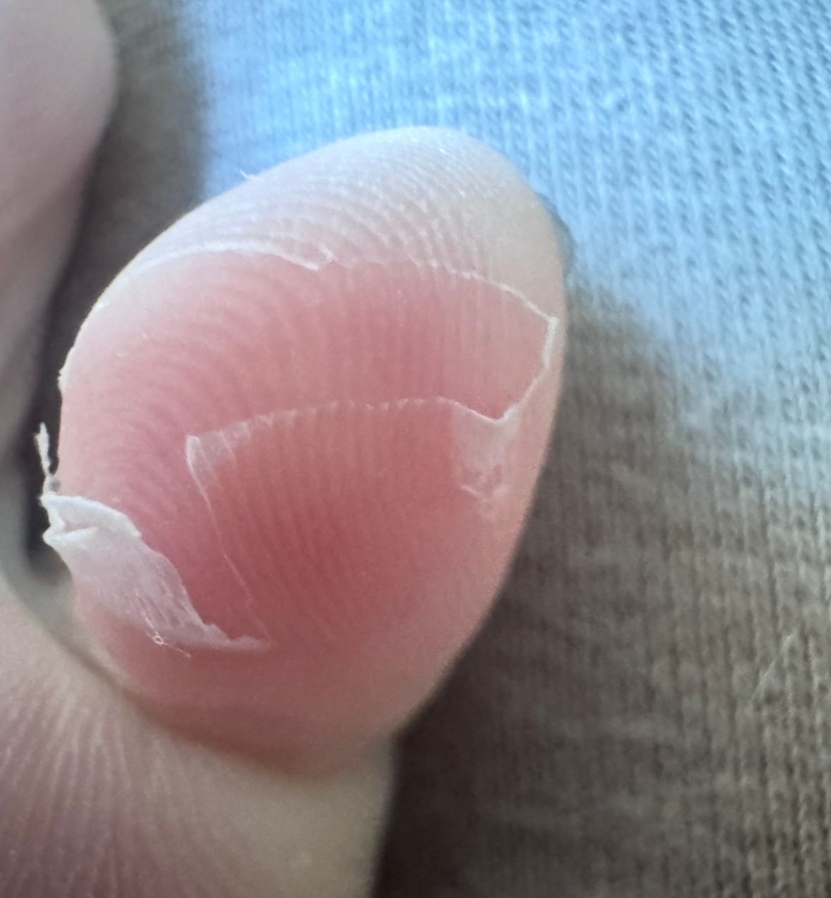 Milky Foot 牛乳之足膜 真實評價/實測照片 byDa**om 1