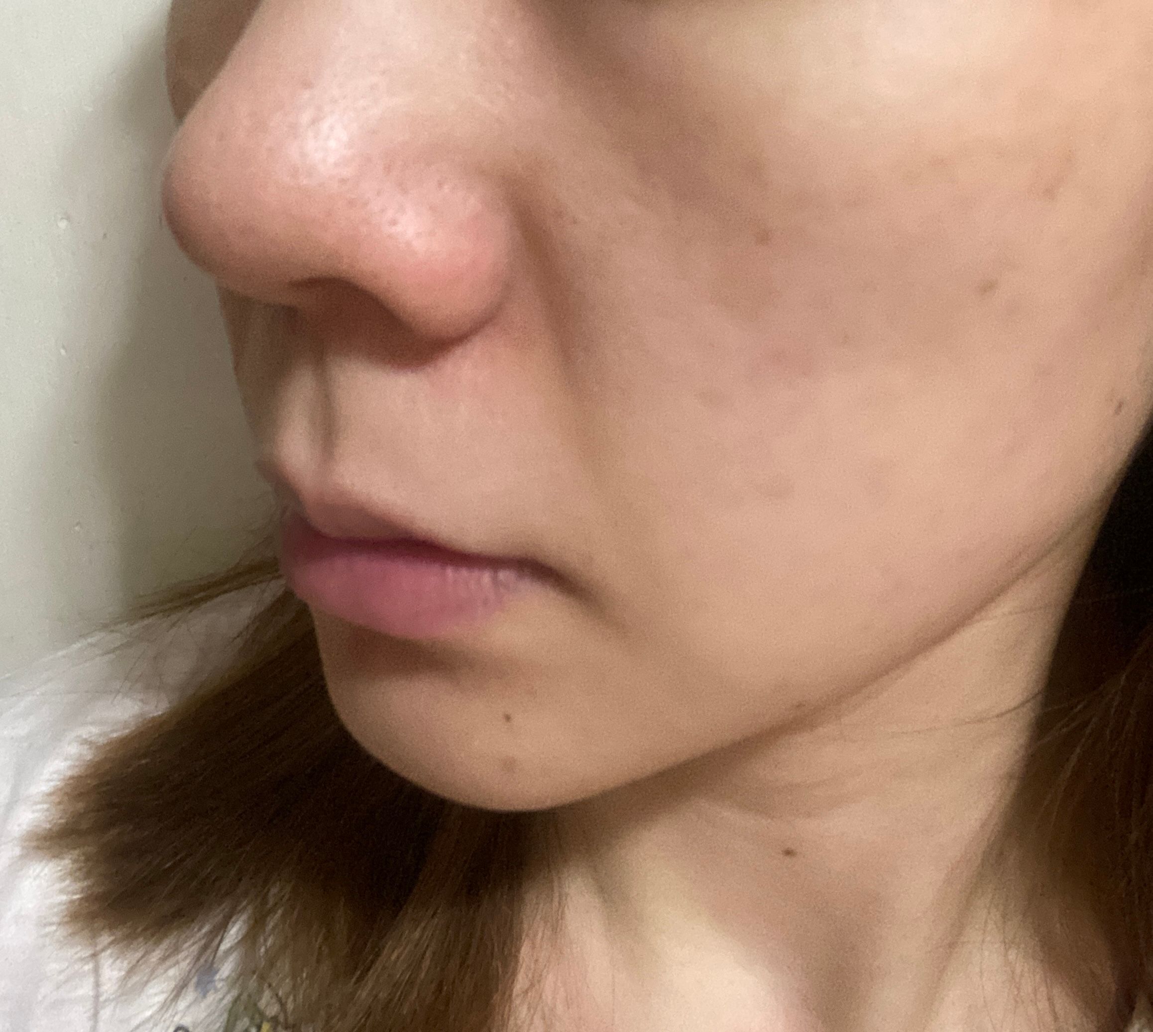 VT Cosmetics 微針精華100 2 Step面膜 真實評價/實測照片 bysiu************com 2