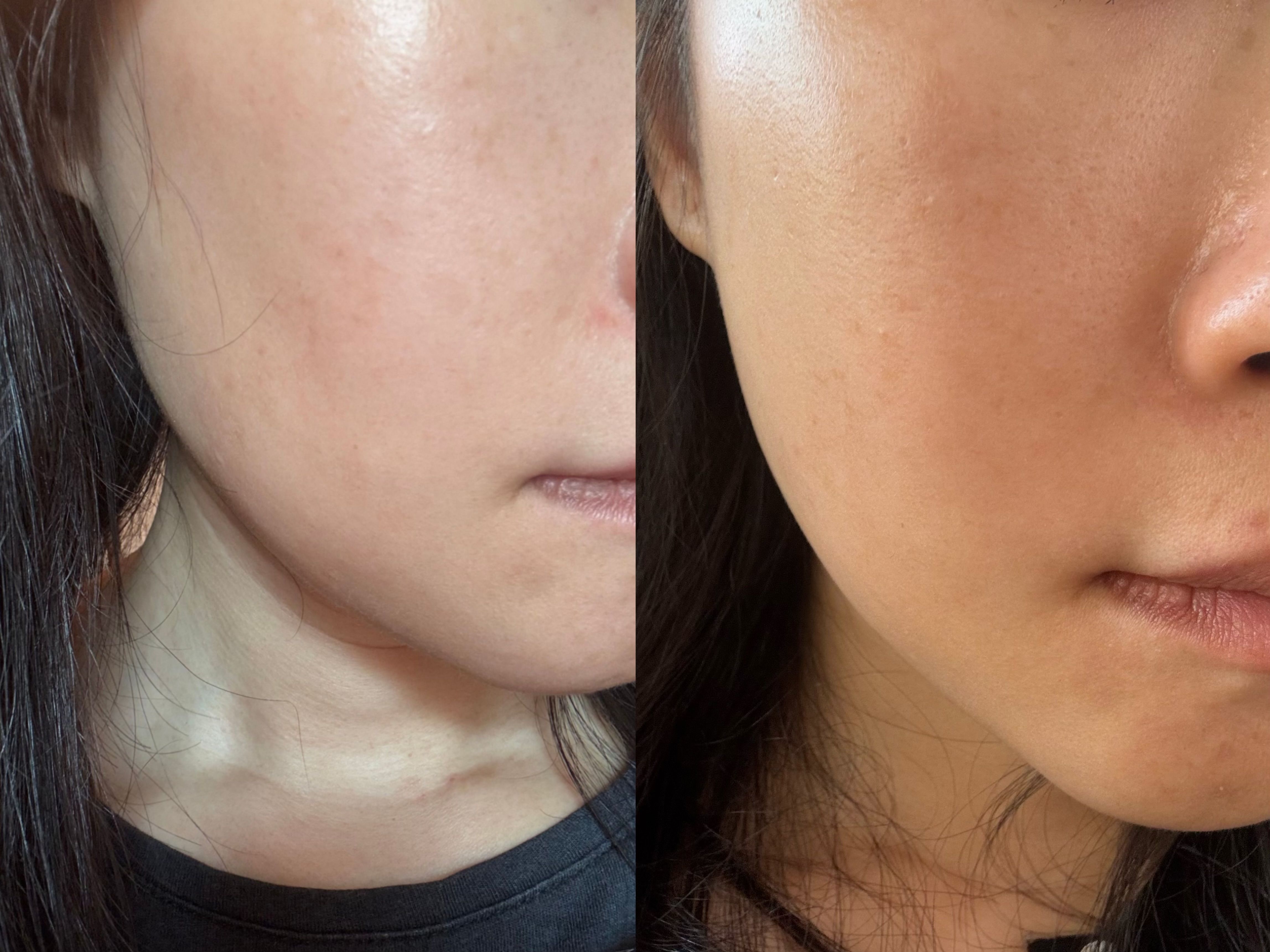 Skin Need 04G 抗醣抗氧阿魏酸BCE精華 真實評價/實測照片 byAsh***ong 1