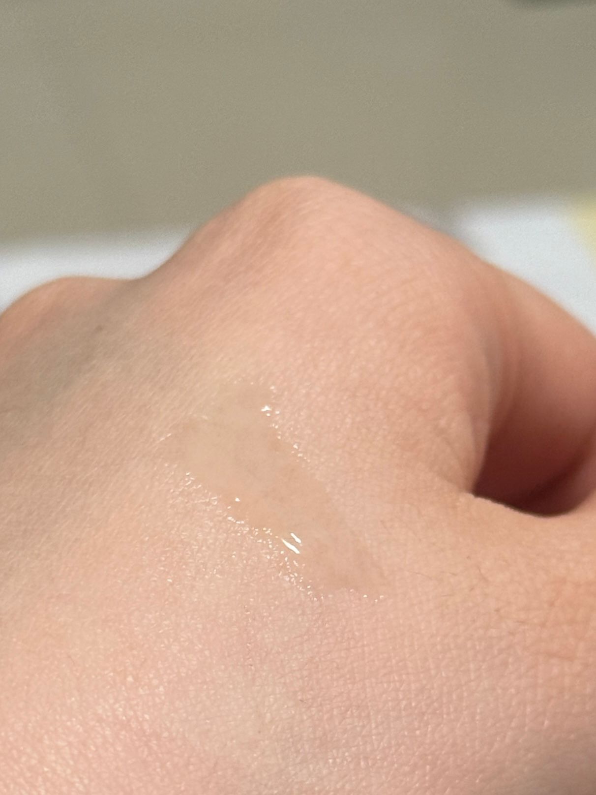 Clear Nose 暗瘡凝膠濃縮護理液 真實評價/實測照片 byAtl**********ung 1