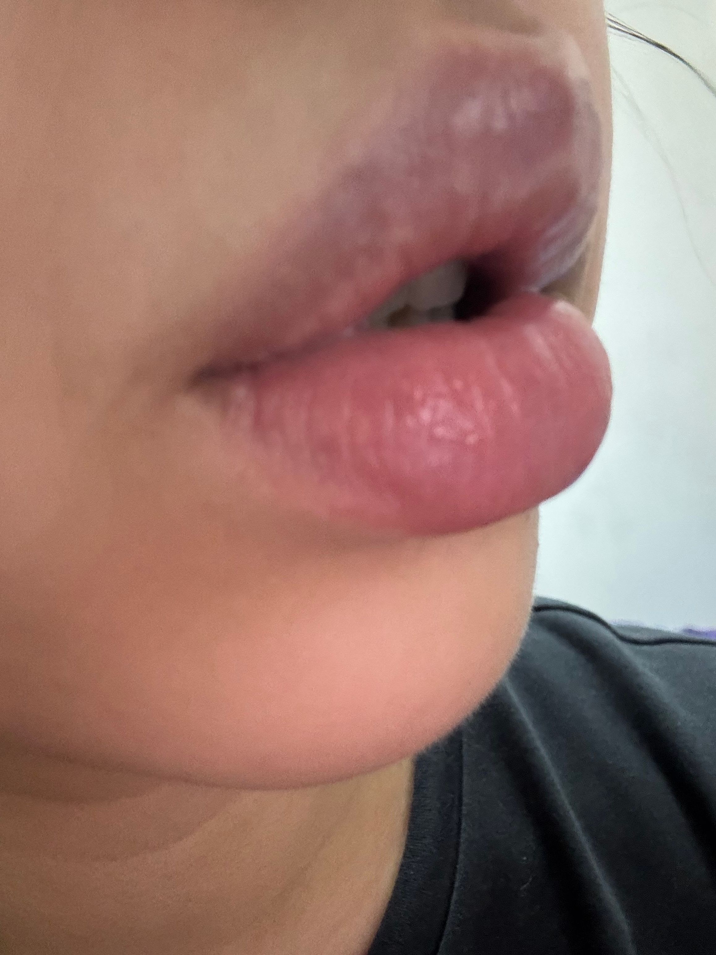 Caudalie 葡萄籽抗氧化護唇膏 真實評價/實測照片 byokk**************com 2