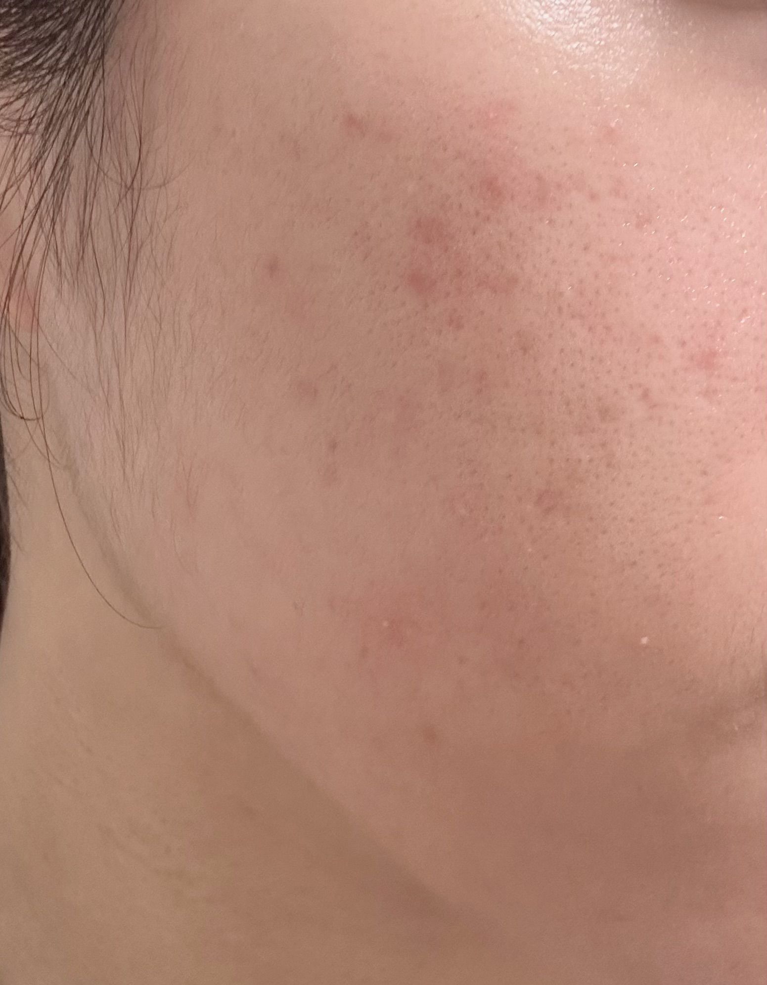 Kiehl's 金盞花植物精華爽膚水 真實評價/用後感 byzet**************com 1 Kiehl's 金盞花植物精華爽膚水 真實評價/實測照片 byzet**************com 1