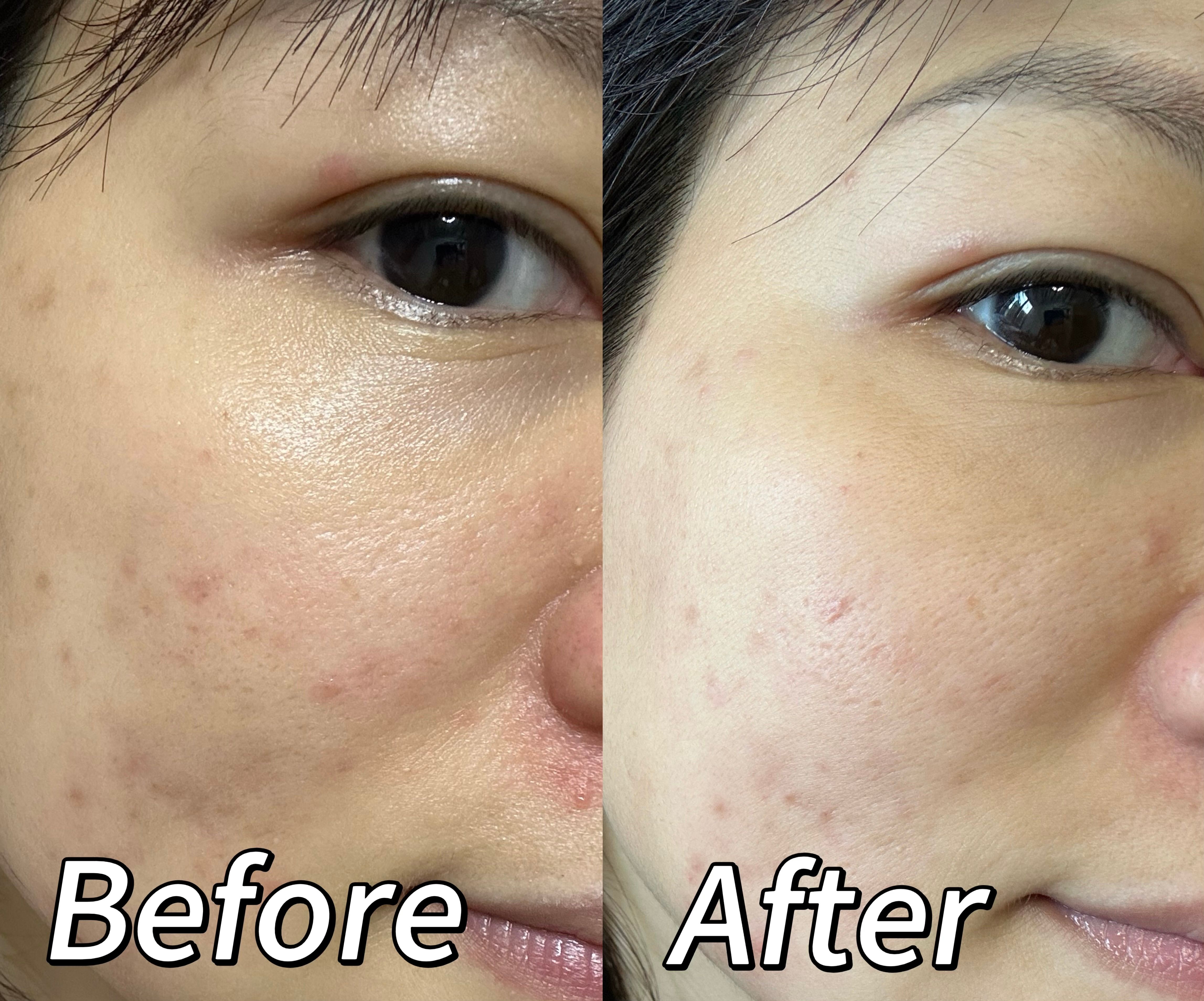 CeraVe 活肌再生A醇抗皺精華 真實評價/實測照片 byCh****an 2