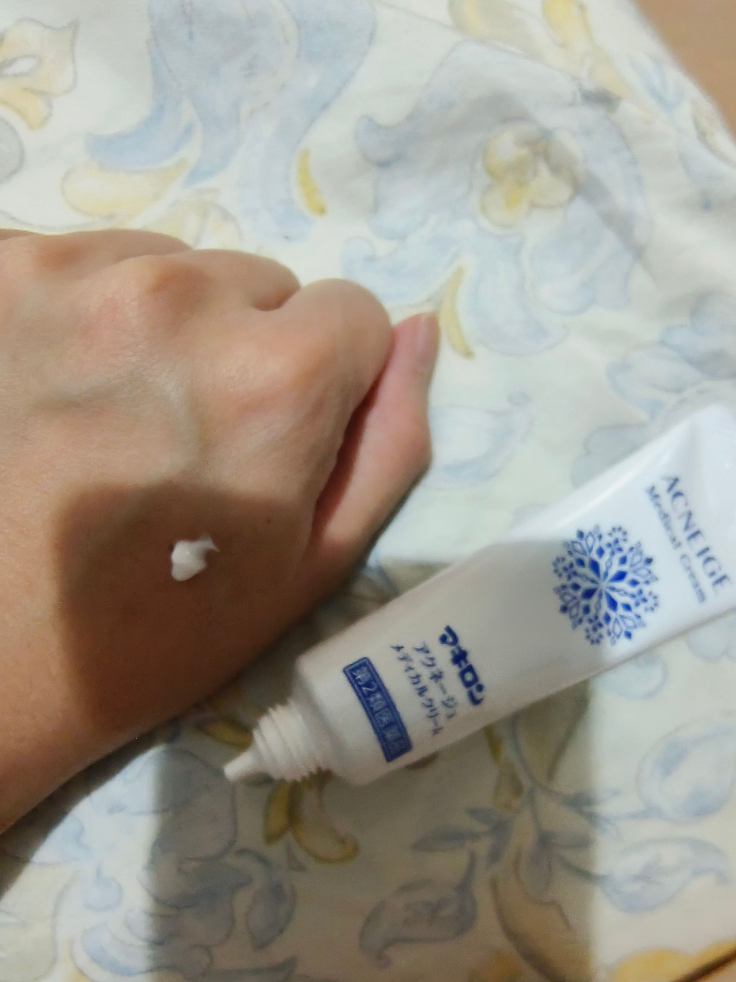 日本第一三共 ACNEIGE Medical Cream 真實評價/實測照片 bymei***454 1