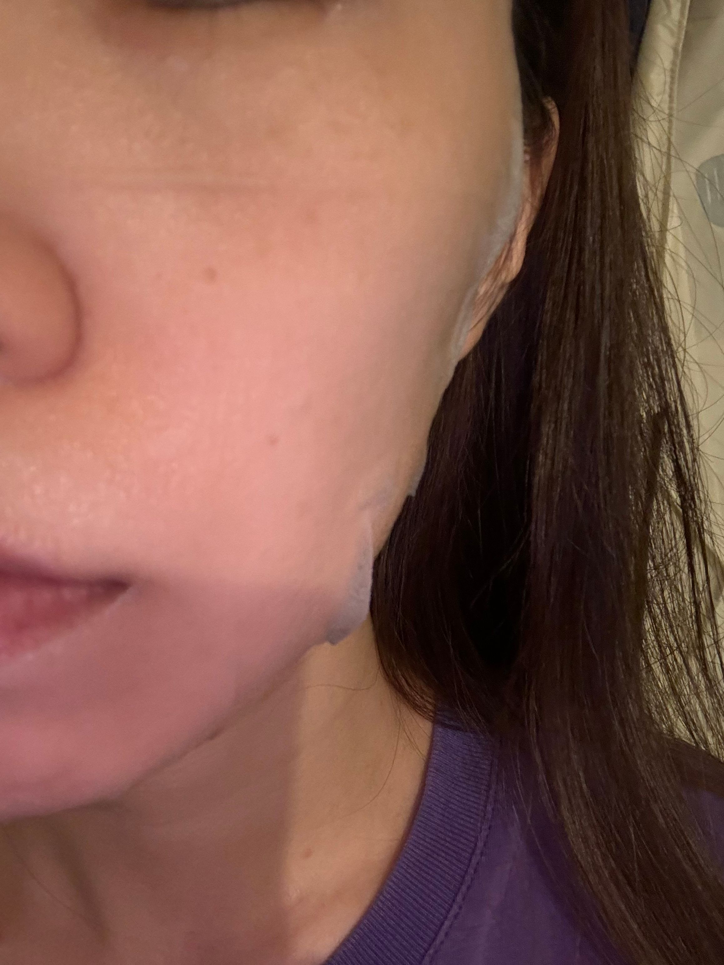 Vecs Gardenia 嘉丹妮爾 杏仁酸亮白淨化面膜 真實評價/實測照片 byRu**cc 1