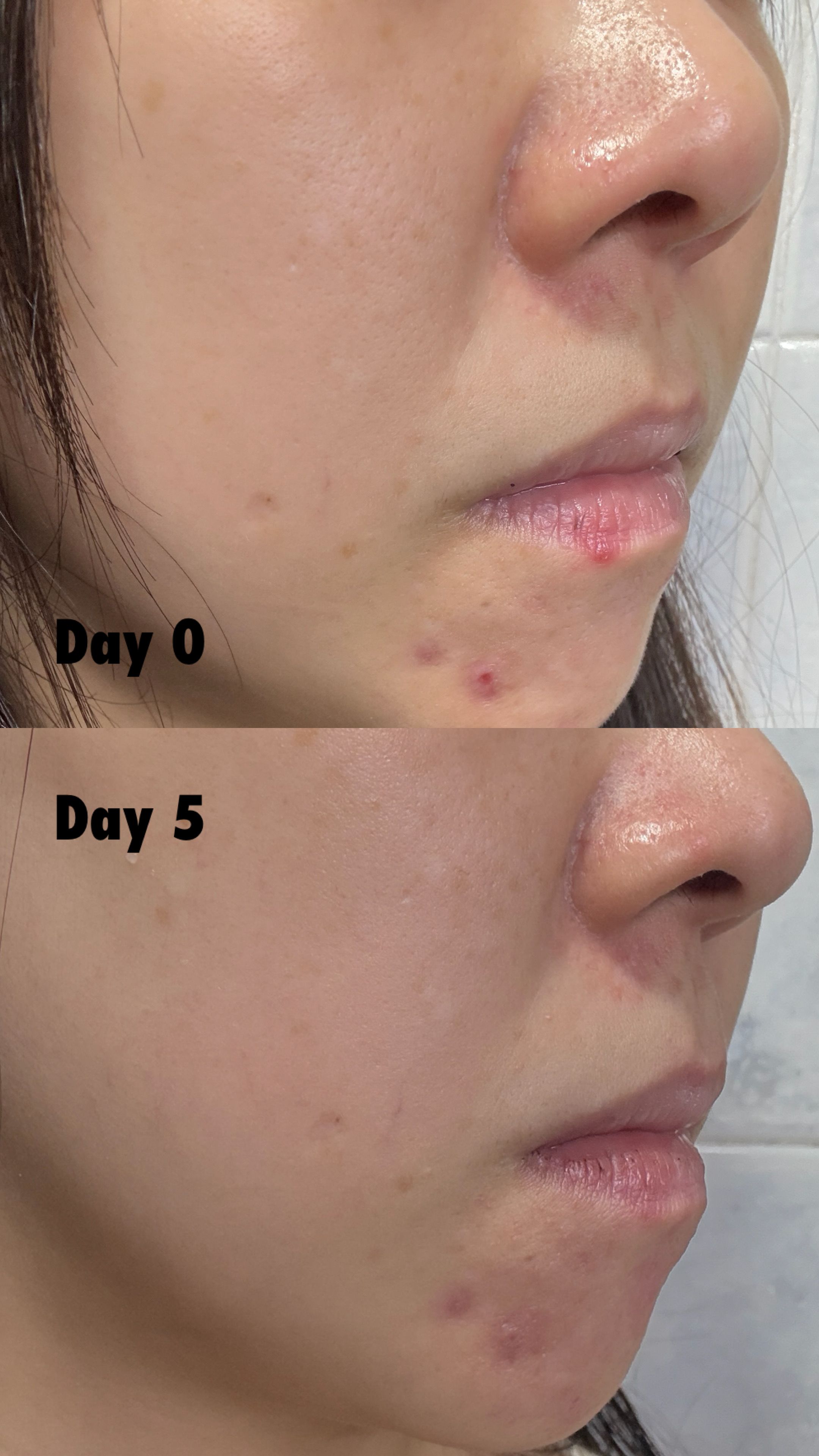 Sasatinnie 第三代升級版全效水潤透光面膜 真實評價/實測照片 byLi****ss 1