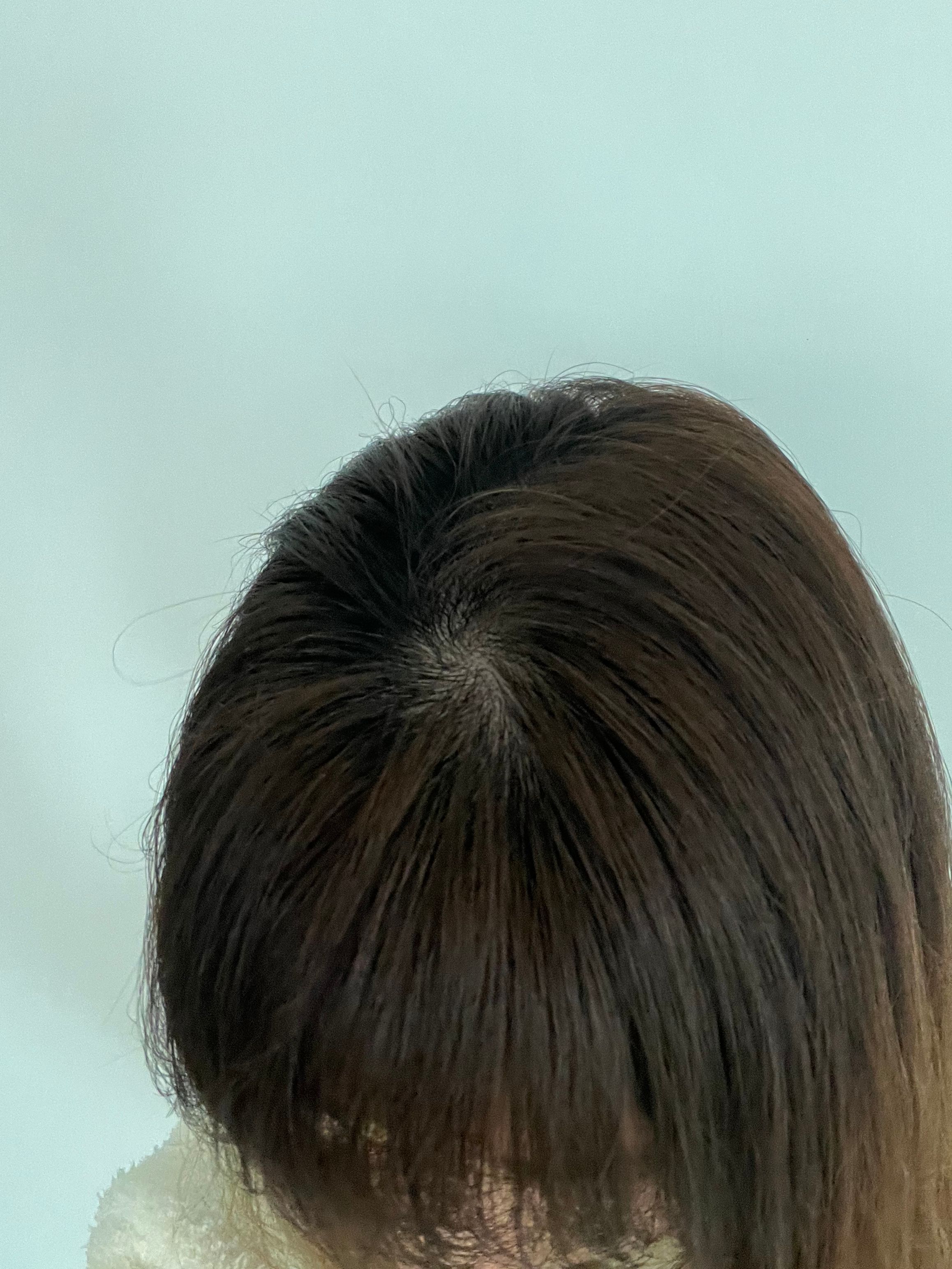 潘婷 Pantene 豐盈防脫頭皮精華 真實評價/用後感 byb**i 2 潘婷 Pantene 豐盈防脫頭皮精華 真實評價/實測照片 byb**i 2