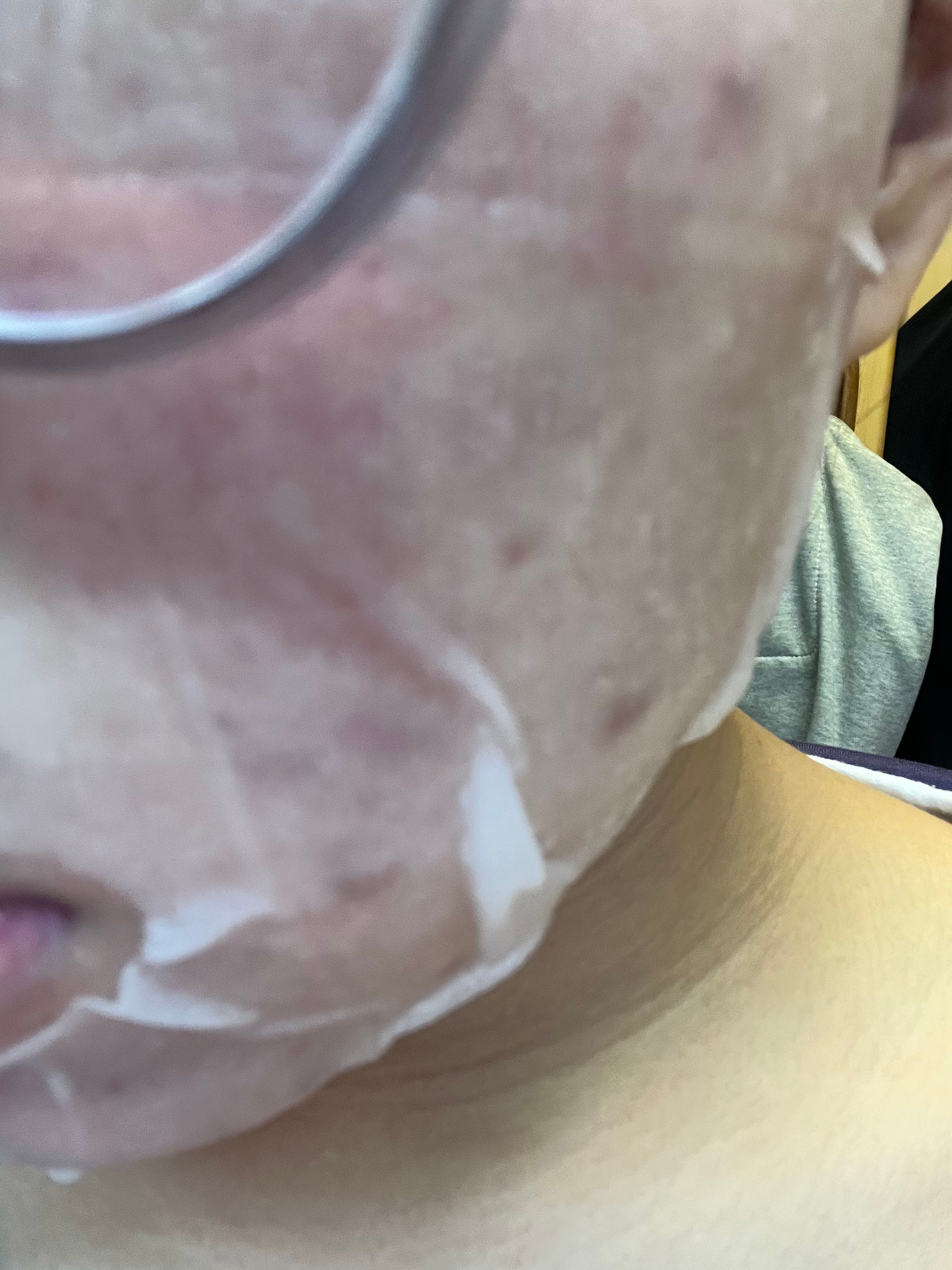 REJURAN 麗珠蘭 SKIN PROTECTION 嬰兒水光針修復煥膚面膜 真實評價/用後感 bymch*************com 1 REJURAN 麗珠蘭 SKIN PROTECTION 嬰兒水光針修復煥膚面膜 真實評價/實測照片 bymch*************com 1
